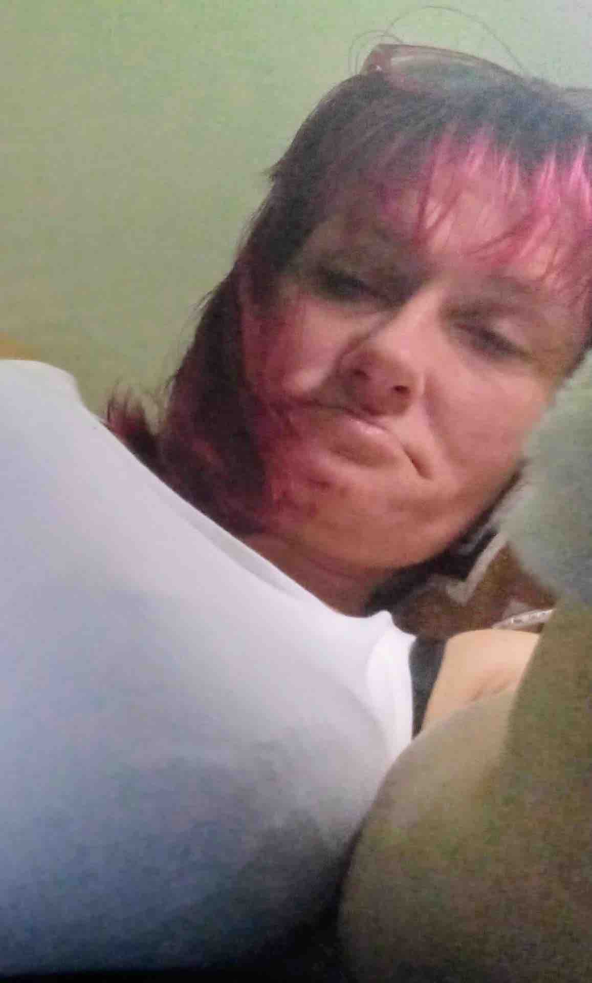 Support Amber Nicole King’s Recovery campaign photo, 2 of 7