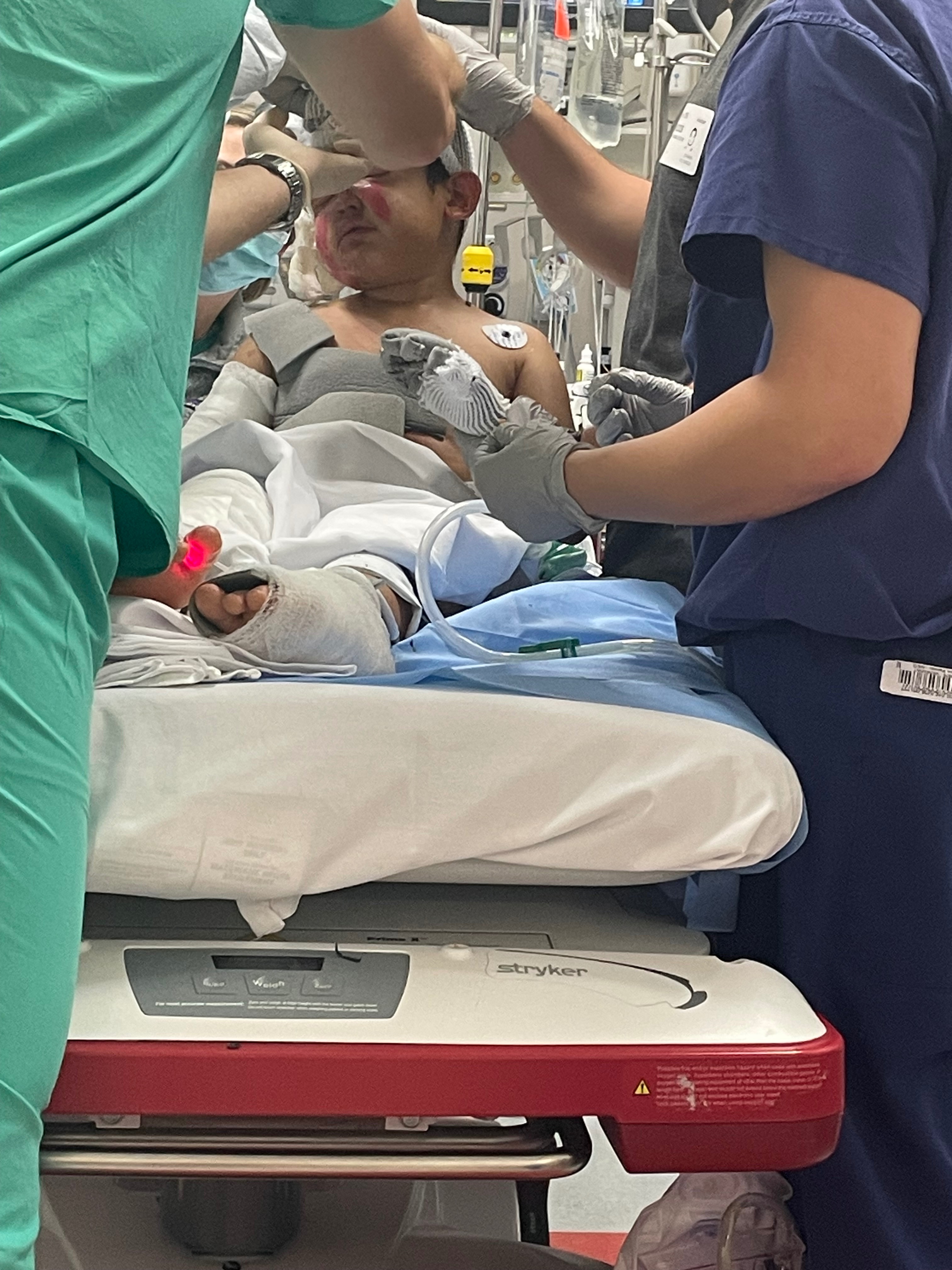 Help 7-Year-Old Elian Heal After Severe Burns campaign photo, 4 of 7