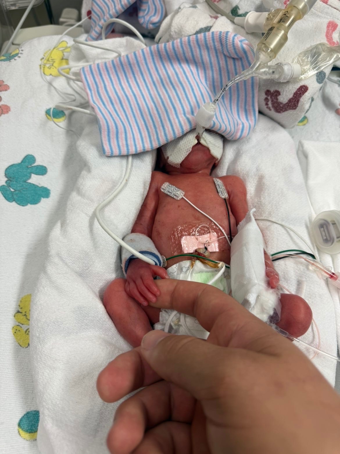 Luke's NICU Journey and Family Support campaign photo, 7 of 8