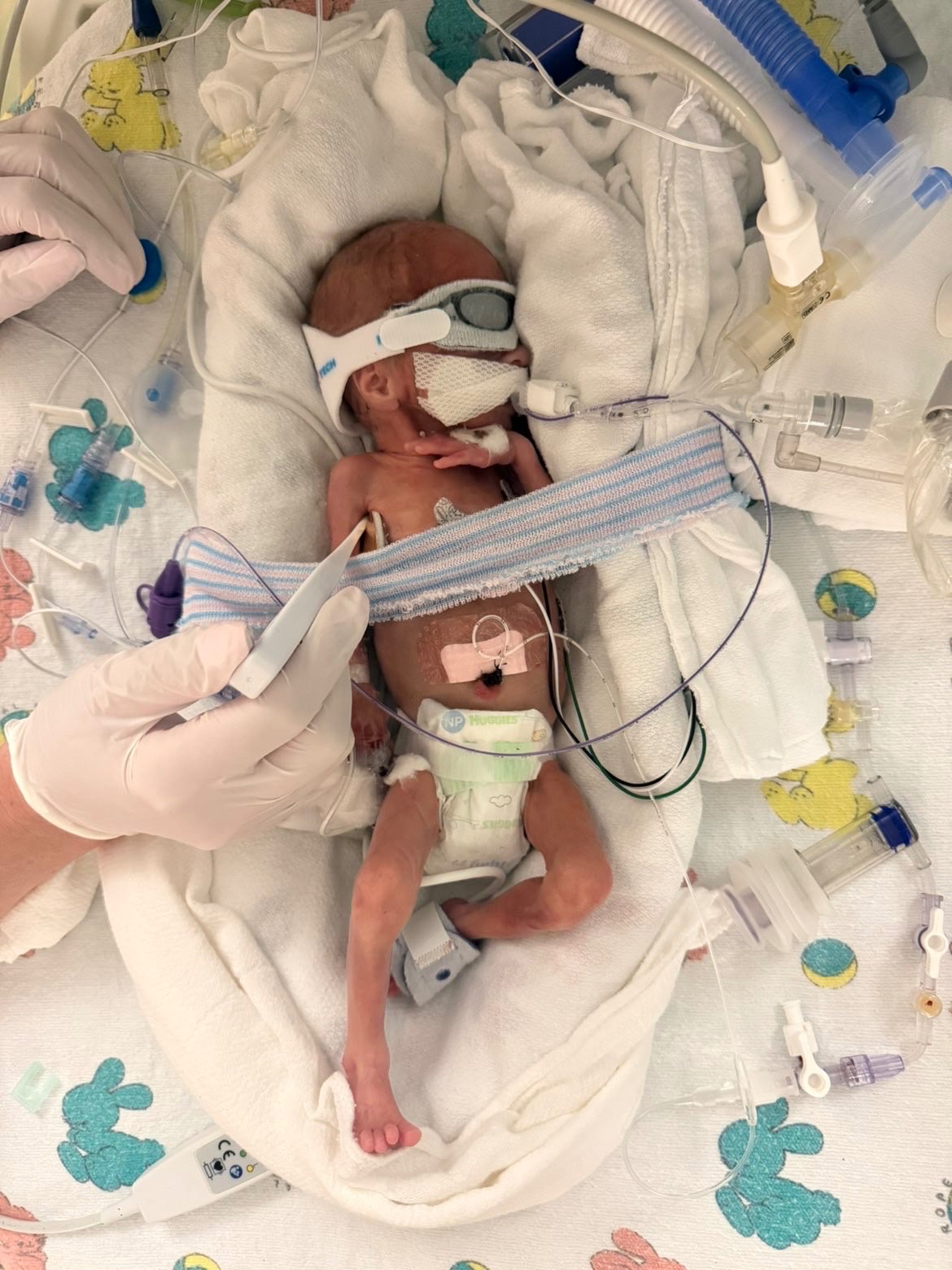 Luke's NICU Journey and Family Support campaign photo, 4 of 8