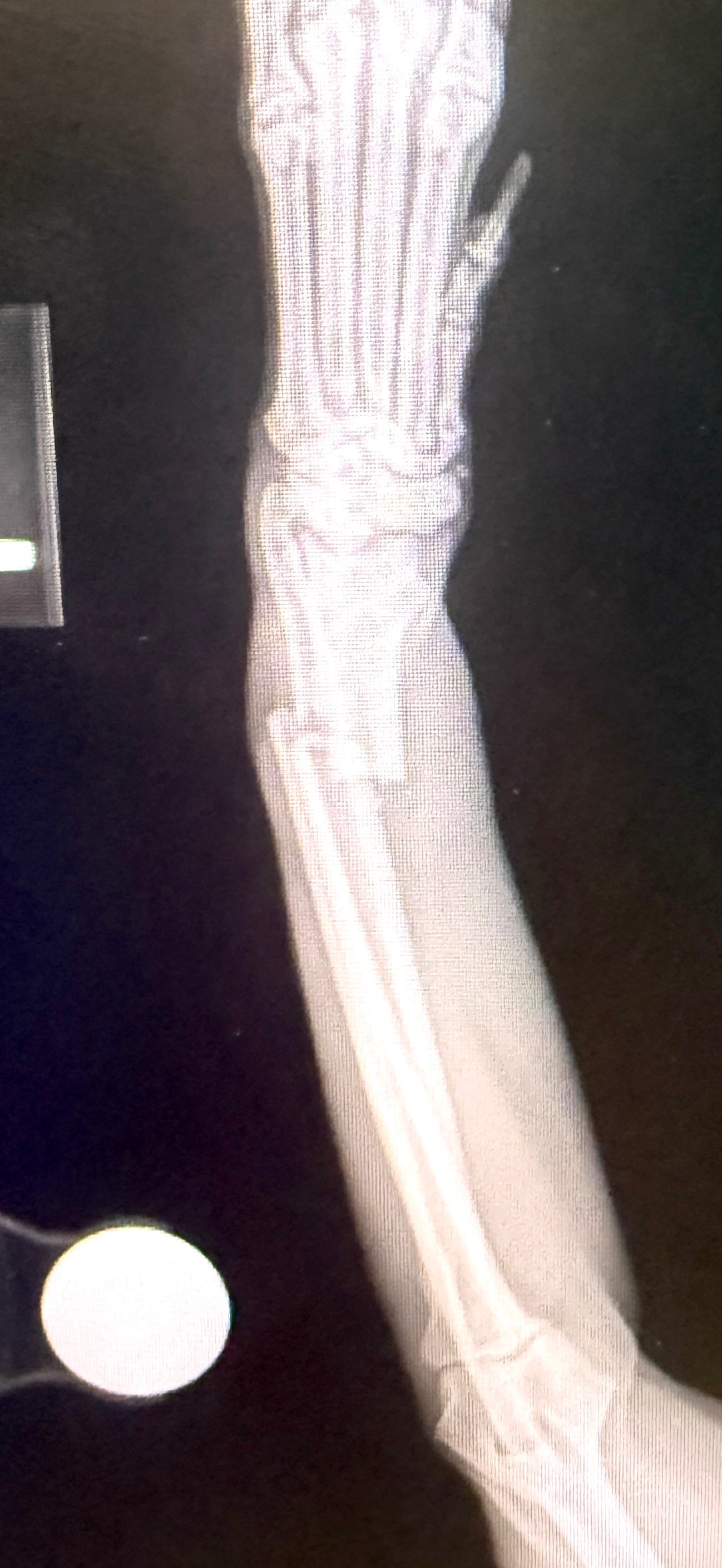 Max Needs Surgery After His Accident campaign photo, 6 of 7