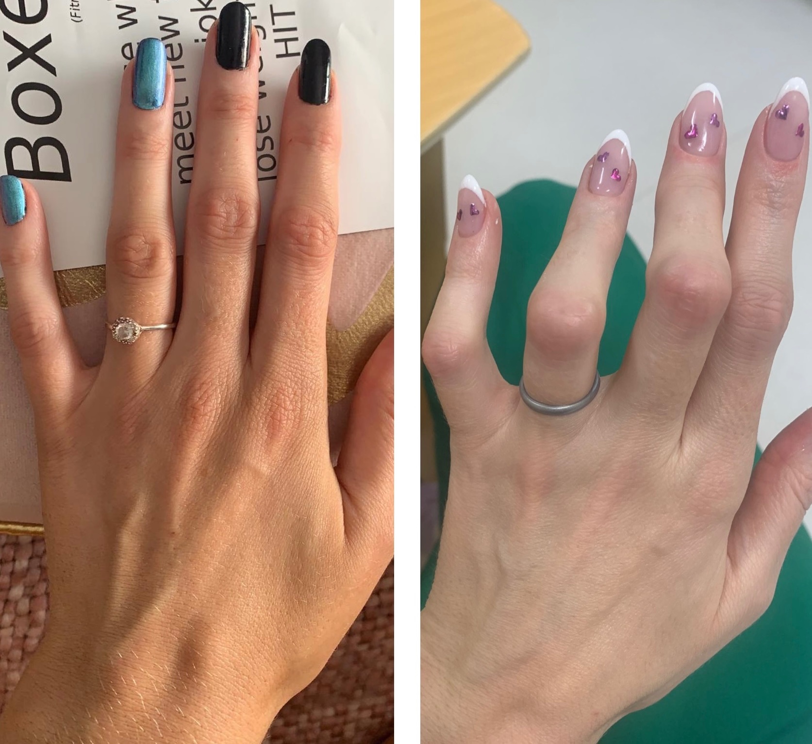 Help Me Save the Use of My Hands campaign photo, 2 of 8