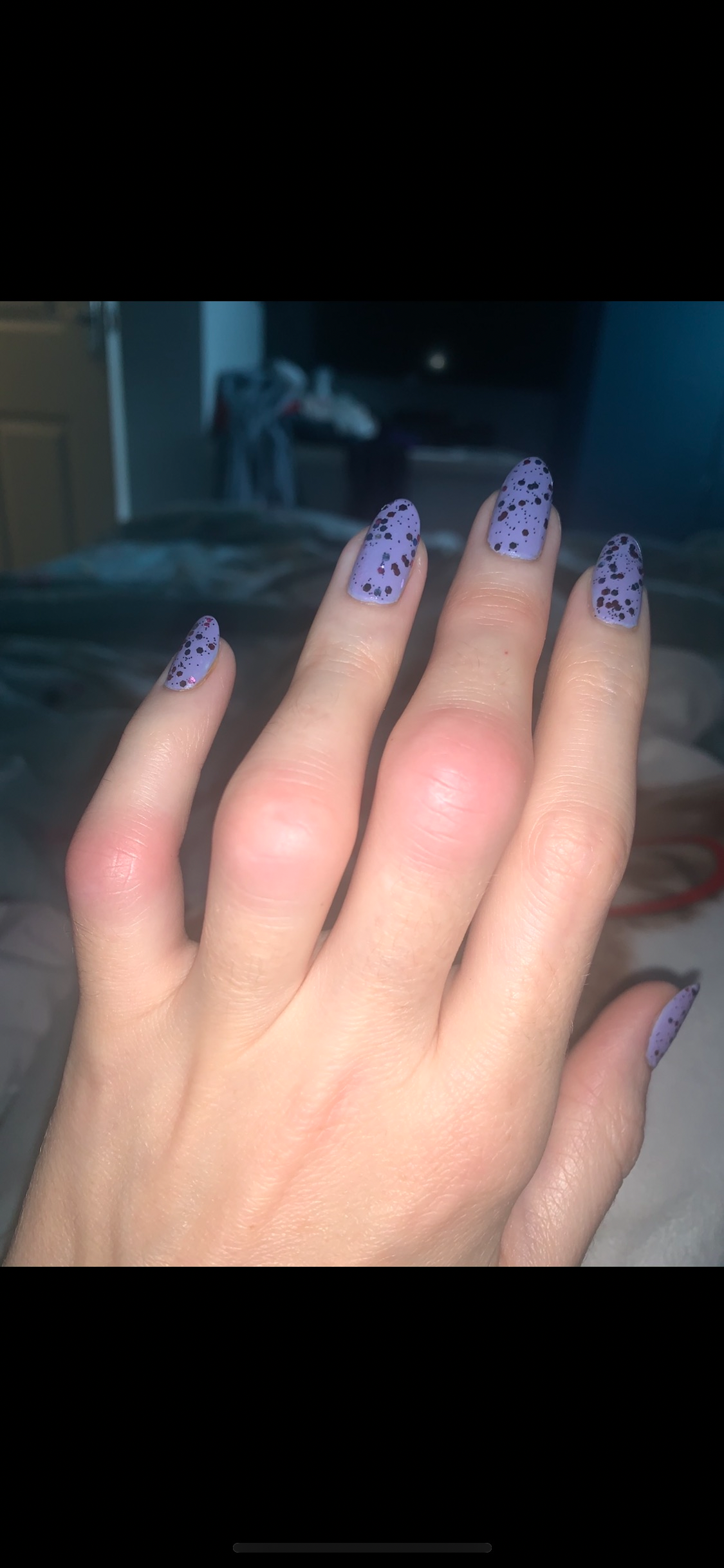 Help Me Save the Use of My Hands campaign photo, 5 of 8