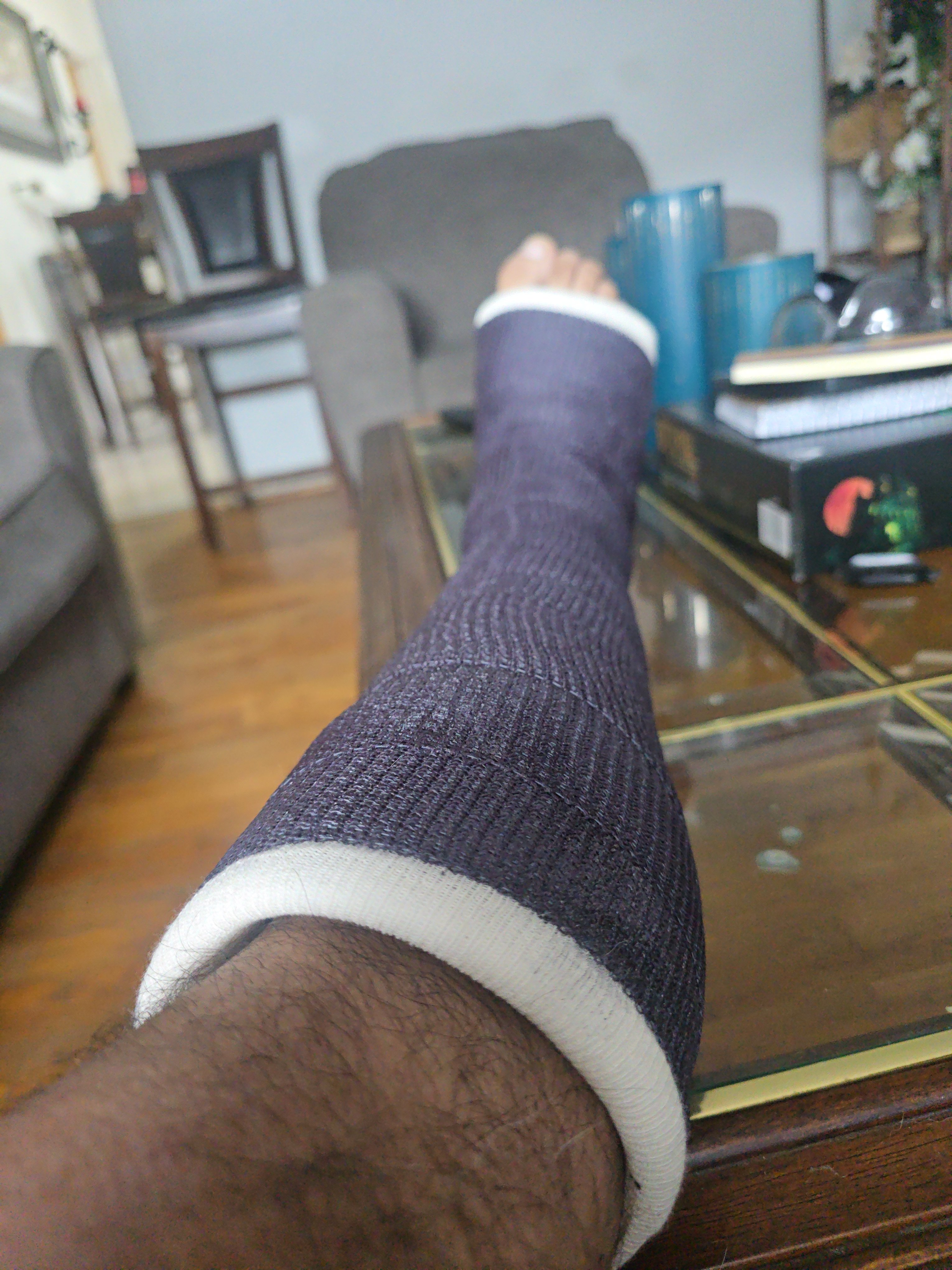 Ricardo Needs a Hand After Breaking His Foot campaign photo, 4 of 5