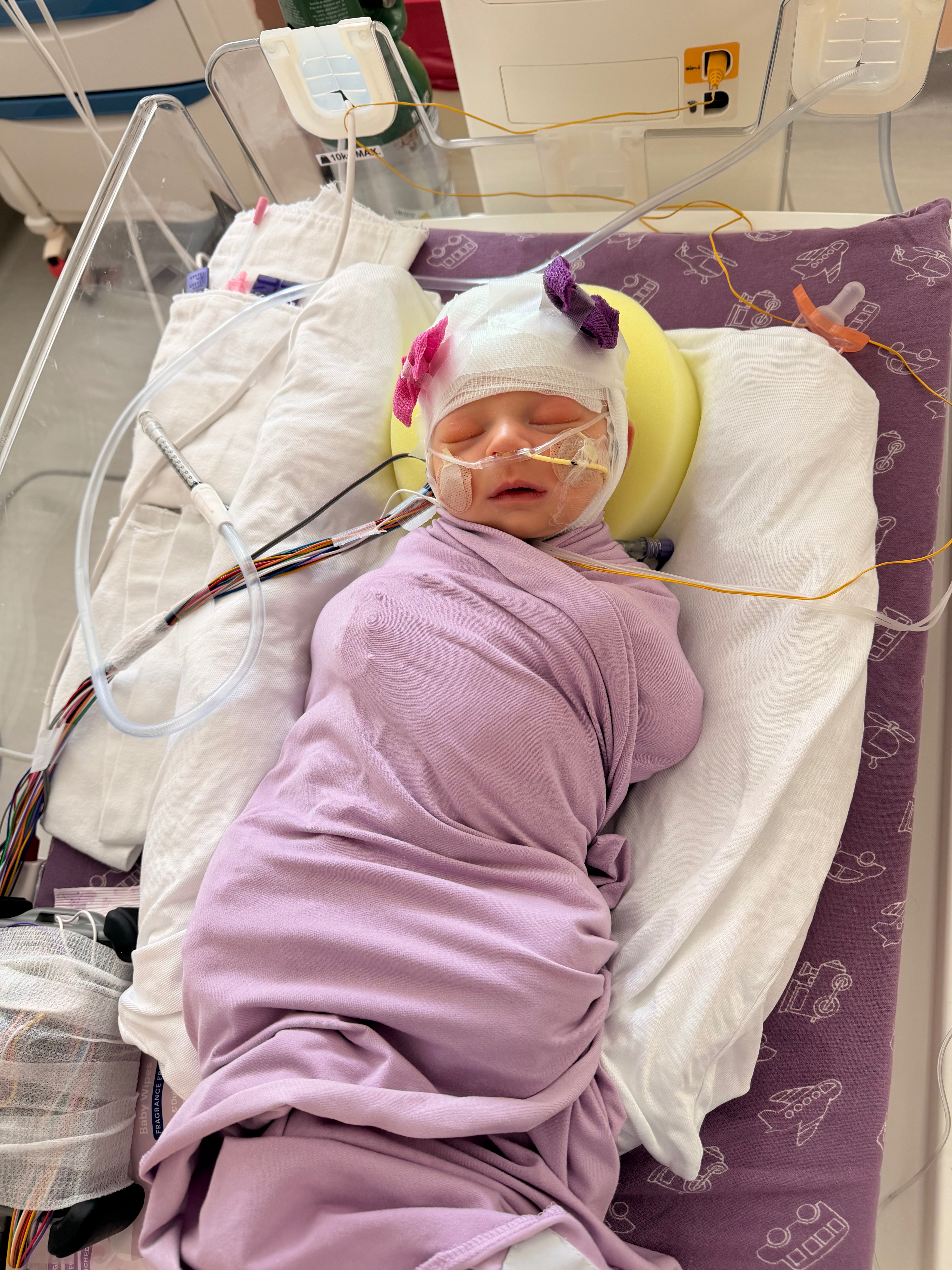 Baby Lennon’s ICU Journey campaign photo, 5 of 8
