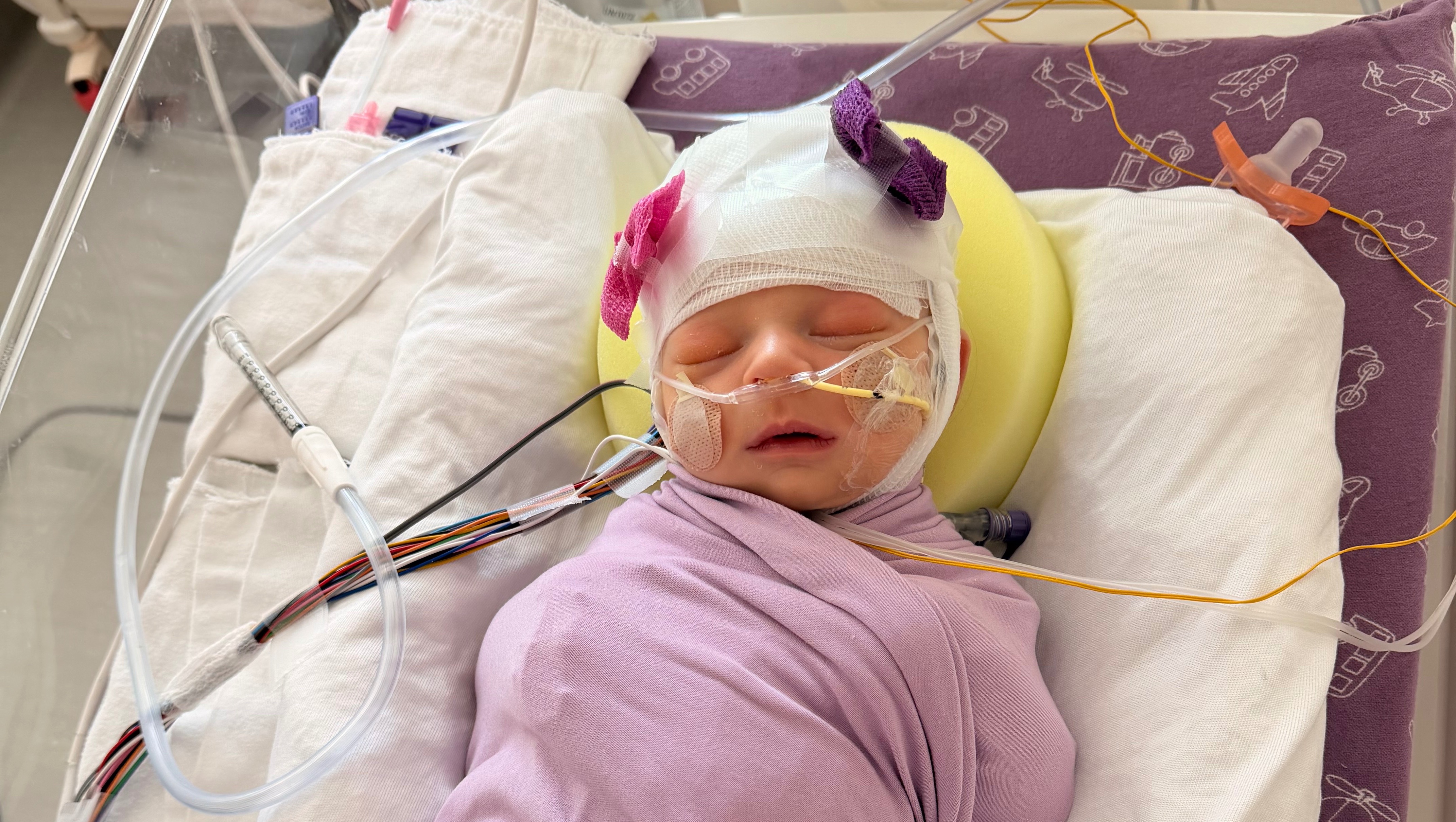 Baby Lennon’s ICU Journey