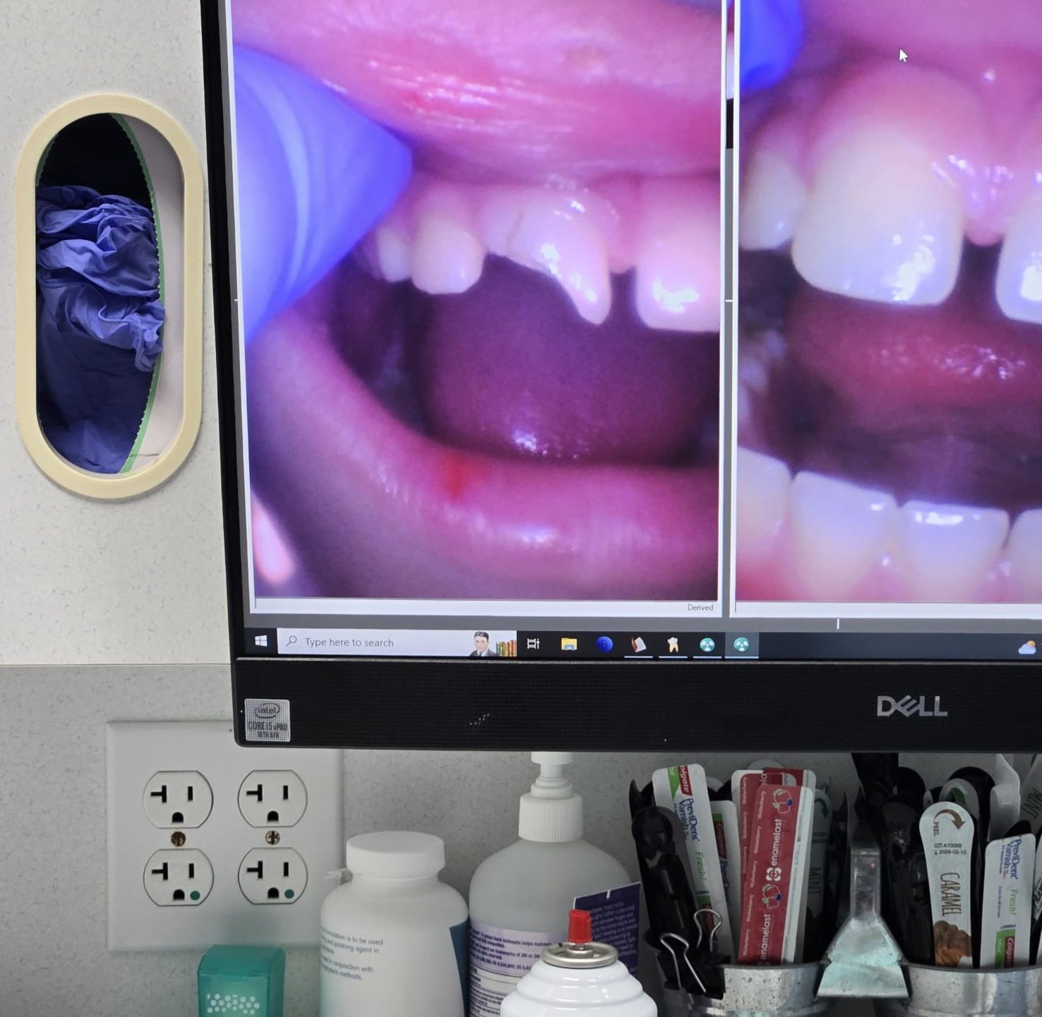 A Little Help for Emma’s Dental Treatment campaign photo, 2 of 4