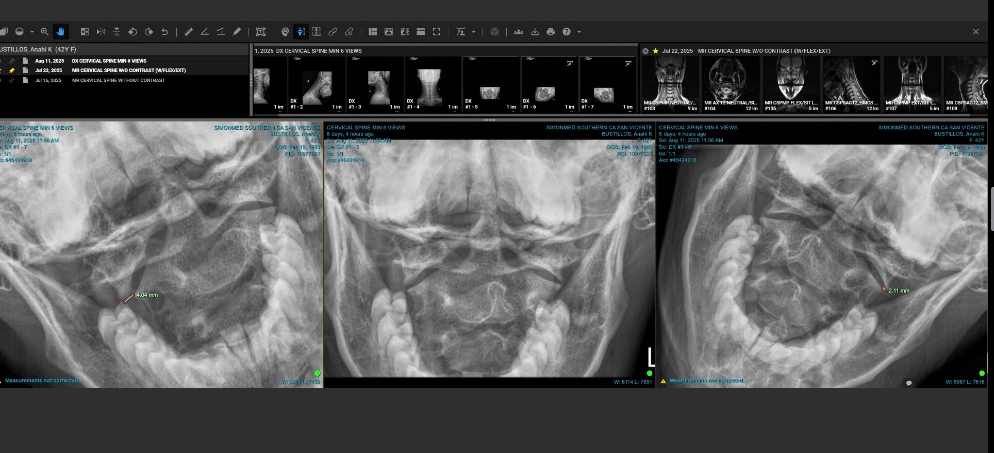 Help Anahi Get Her Life Back after a Cervical Injury campaign photo, 2 of 8