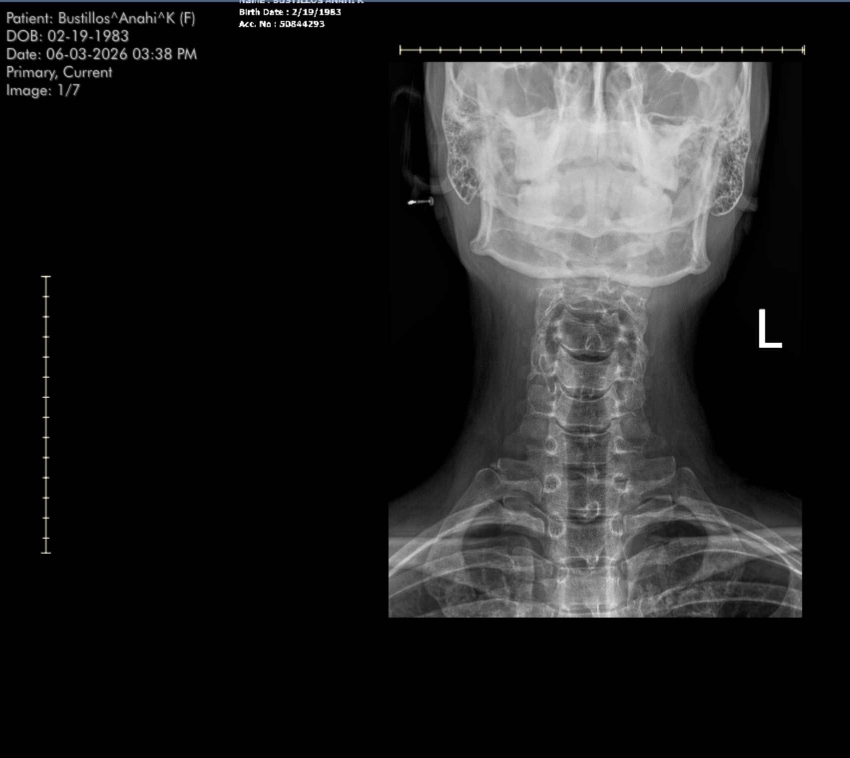 Help Anahi Get Her Life Back after a Cervical Injury campaign photo, 6 of 8