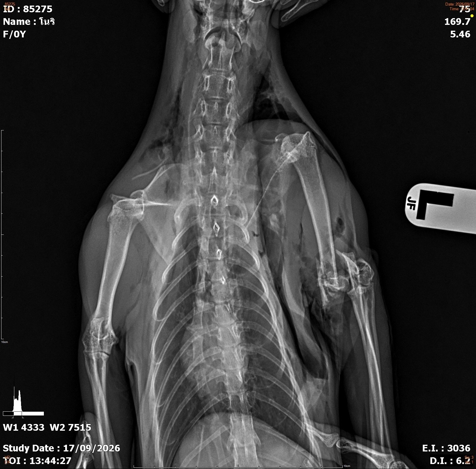 Support Nori’s Surgery After Her Accident campaign photo, 5 of 8