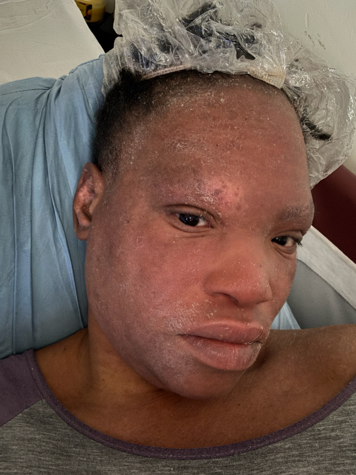 God’s Grace Through Cancer: Help Erica Rebuild campaign photo, 4 of 8