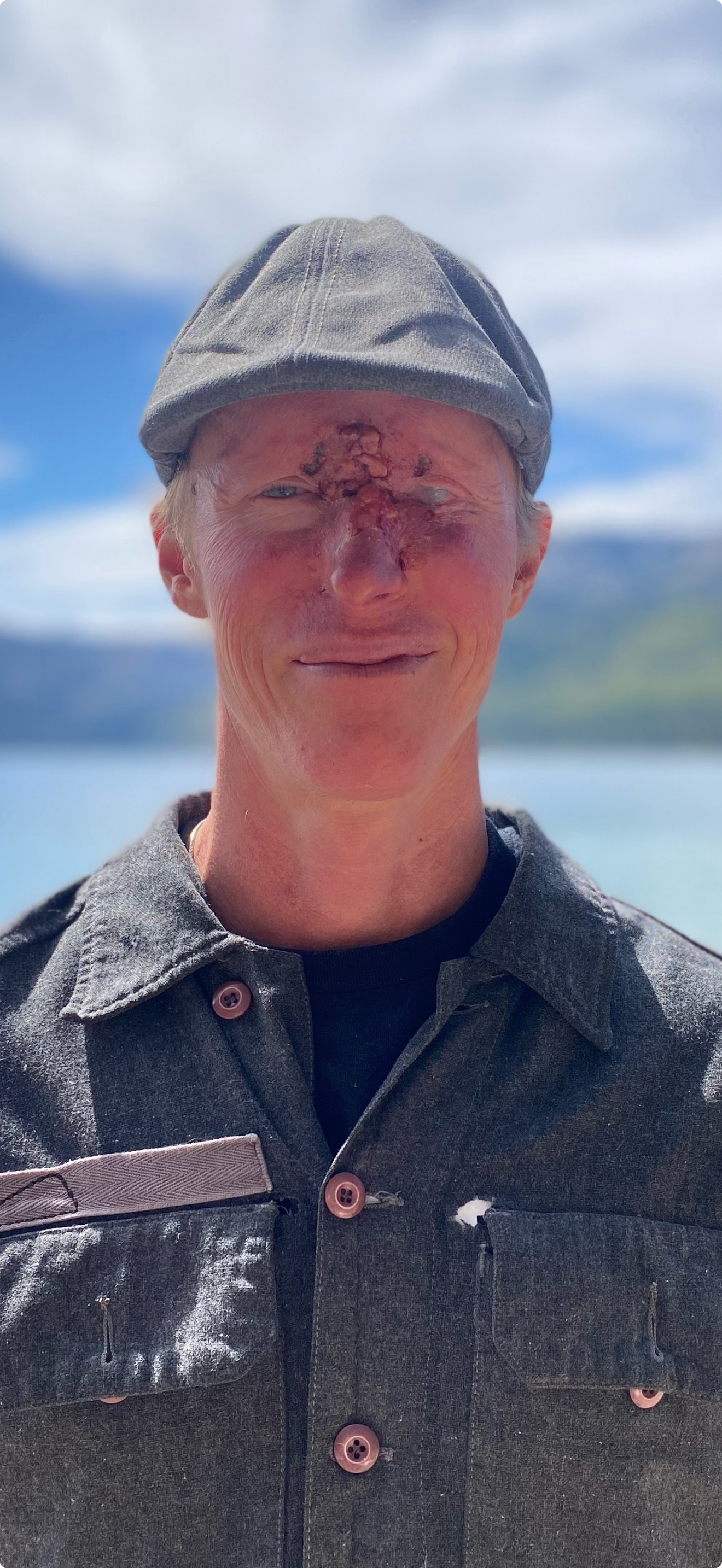Please stand with Abe in his fight to save his remaining eye campaign photo, 6 of 7