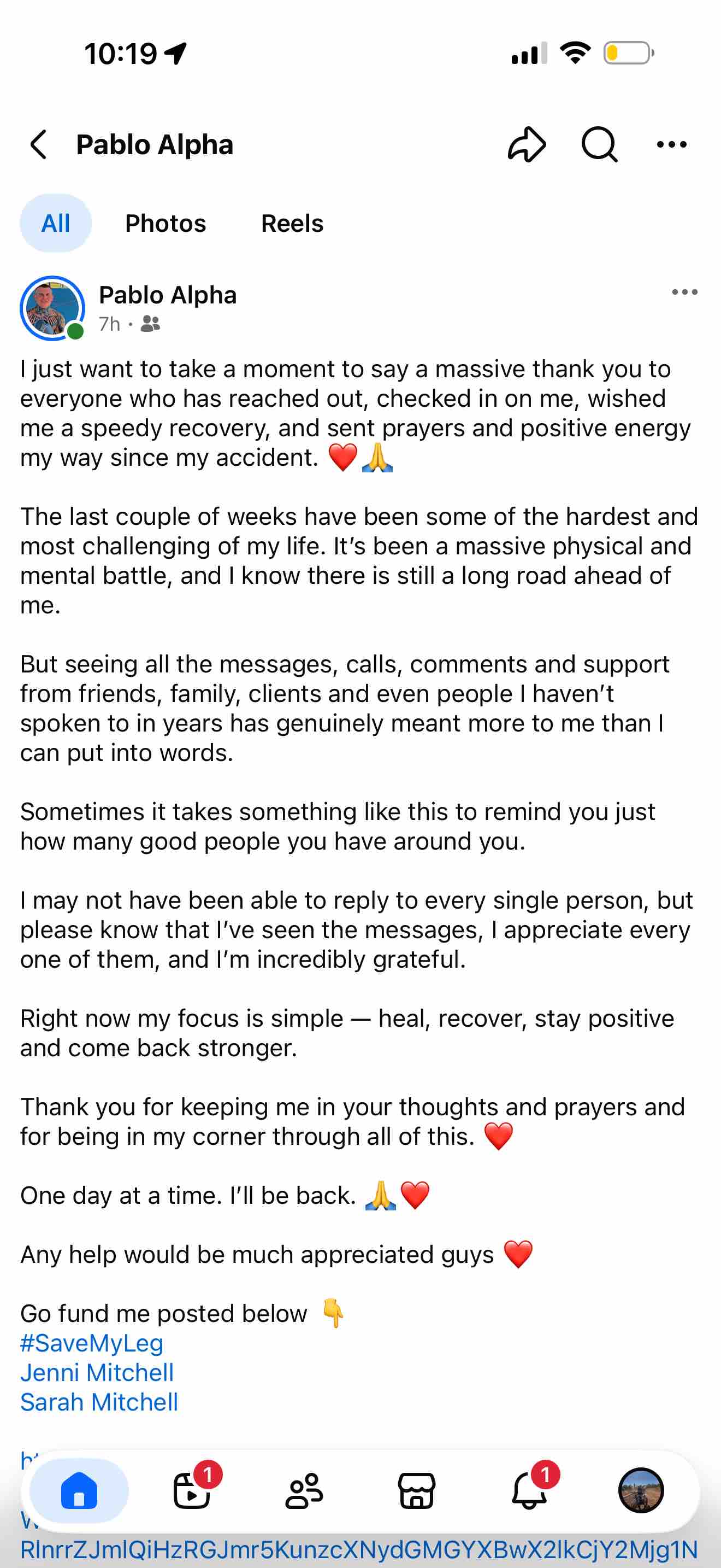 Help Jordy recover from a life changing leg injury campaign photo, 4 of 11