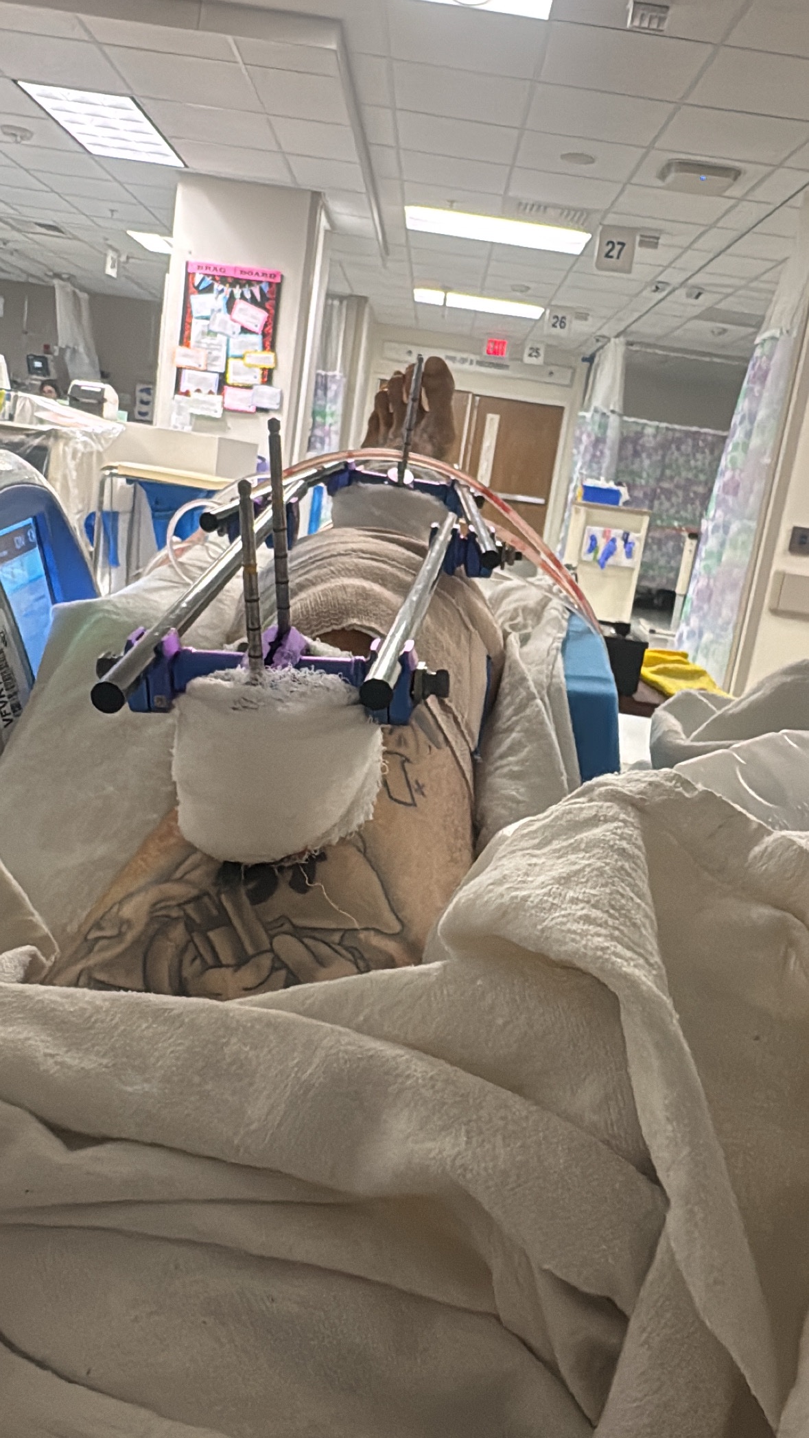 Foto van campagne Help Chance recover from a Hit-and-Run, 7 van 8