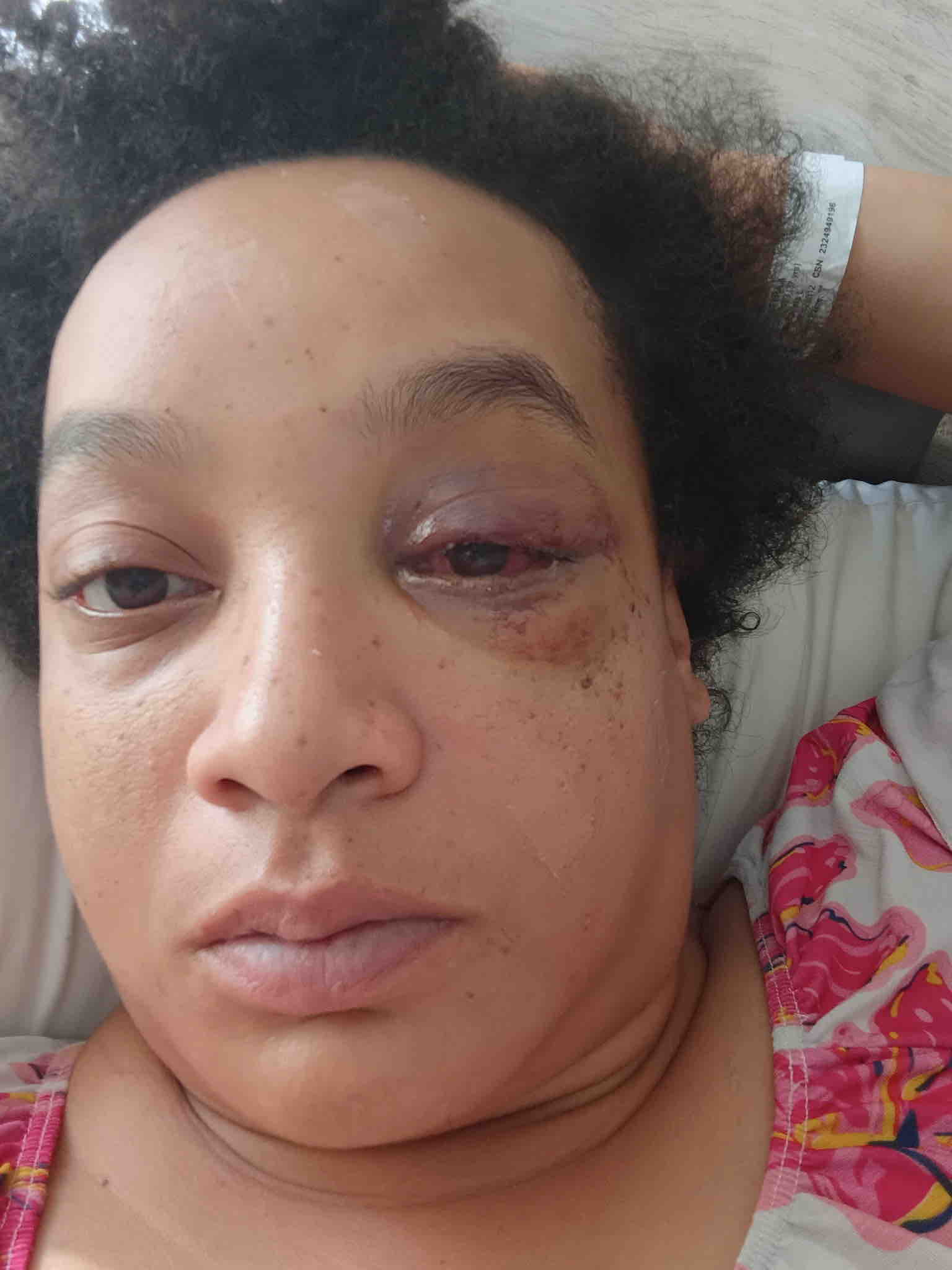 Support Kiesha and Her Son’s Recovery campaign photo, 2 of 4