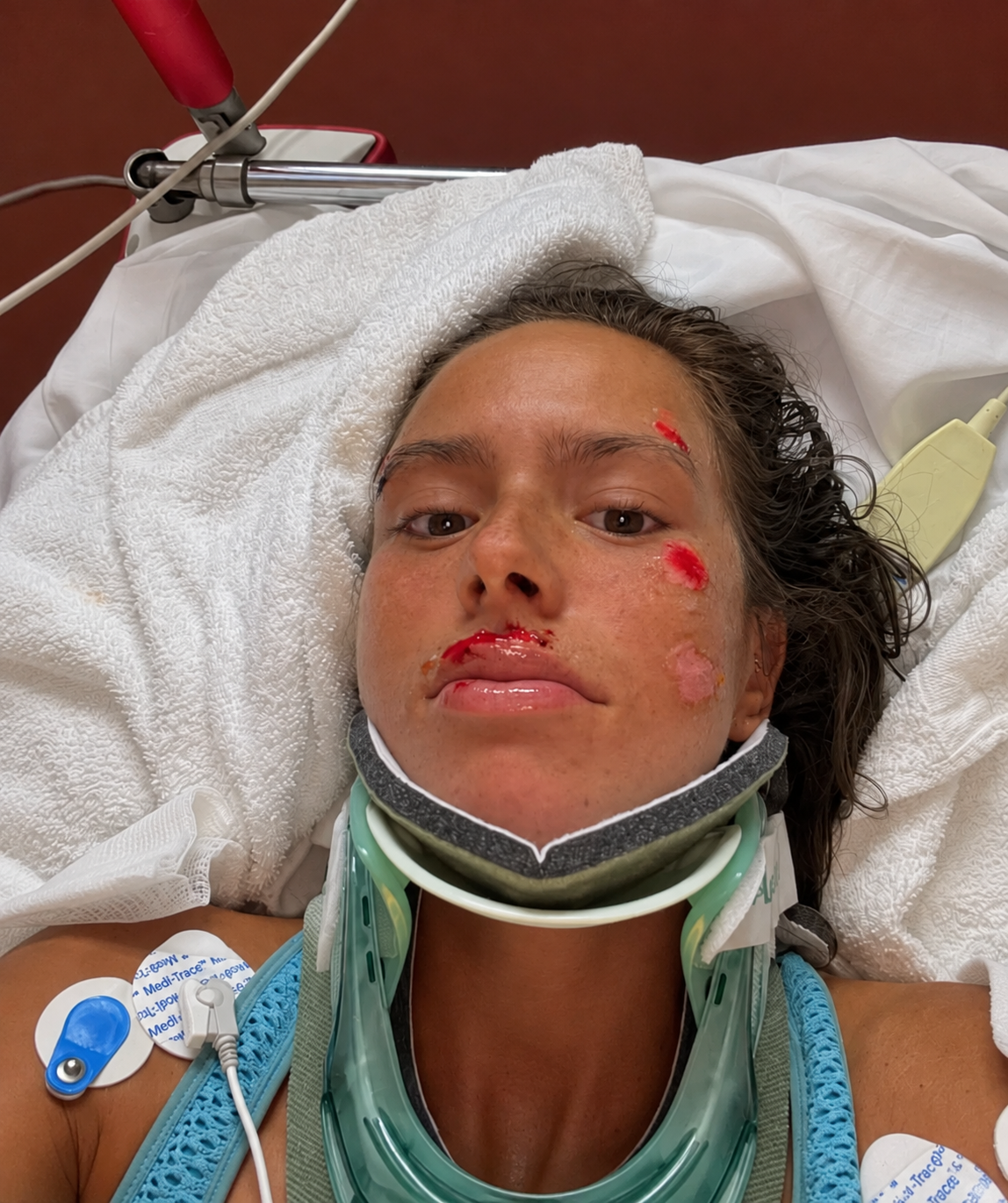 Help Felicia Recover From a Life-Changing Car Accident ❤️ campaign photo, 4 of 7