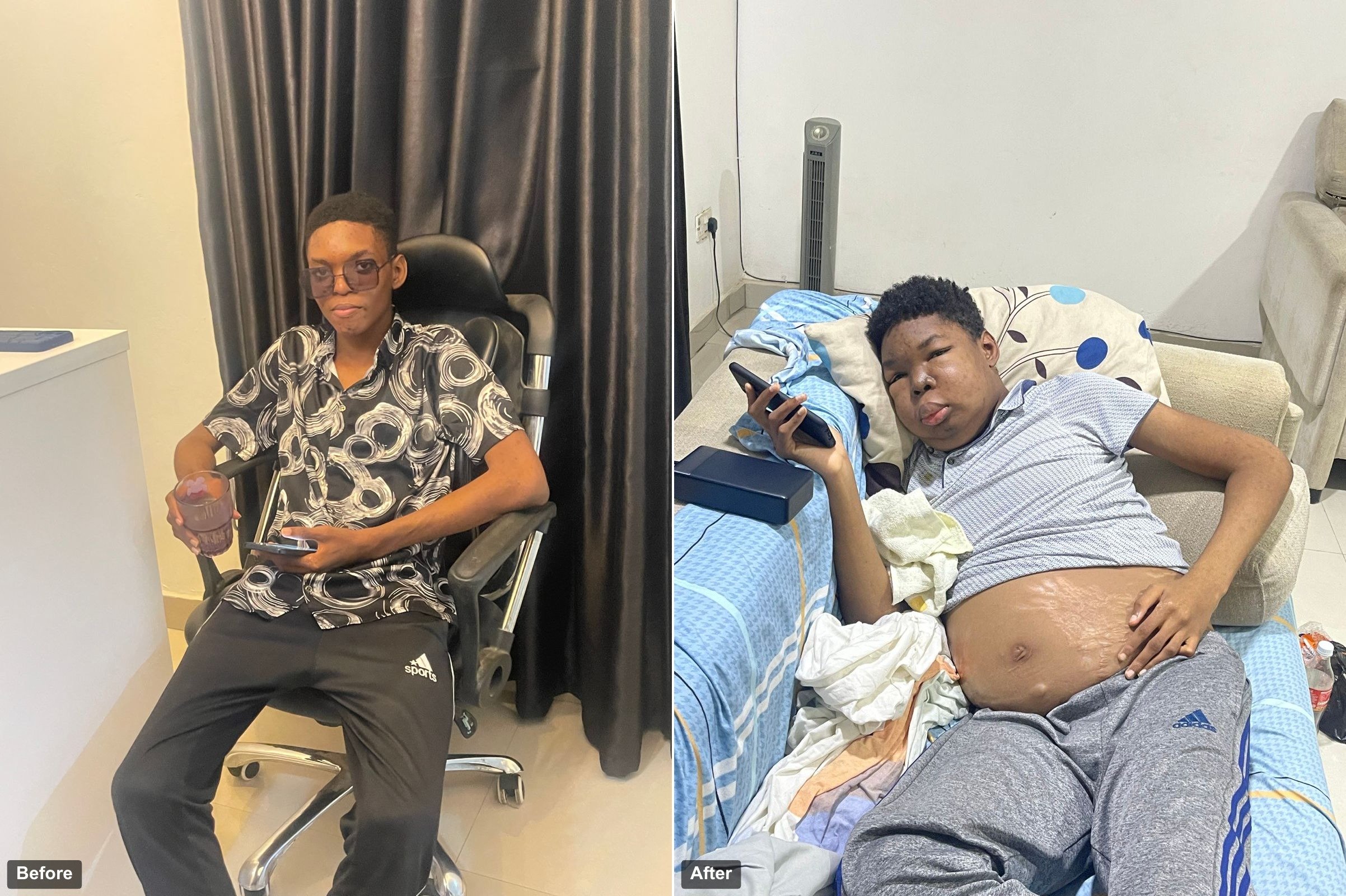 Help Kachi beat nephrotic syndrome campaign photo, 2 of 4