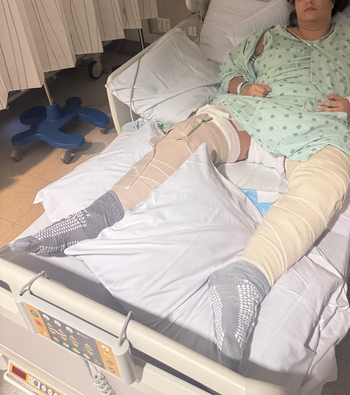 Help Ashley Recover from a Traumatic Dog Attack campaign photo, 2 of 7