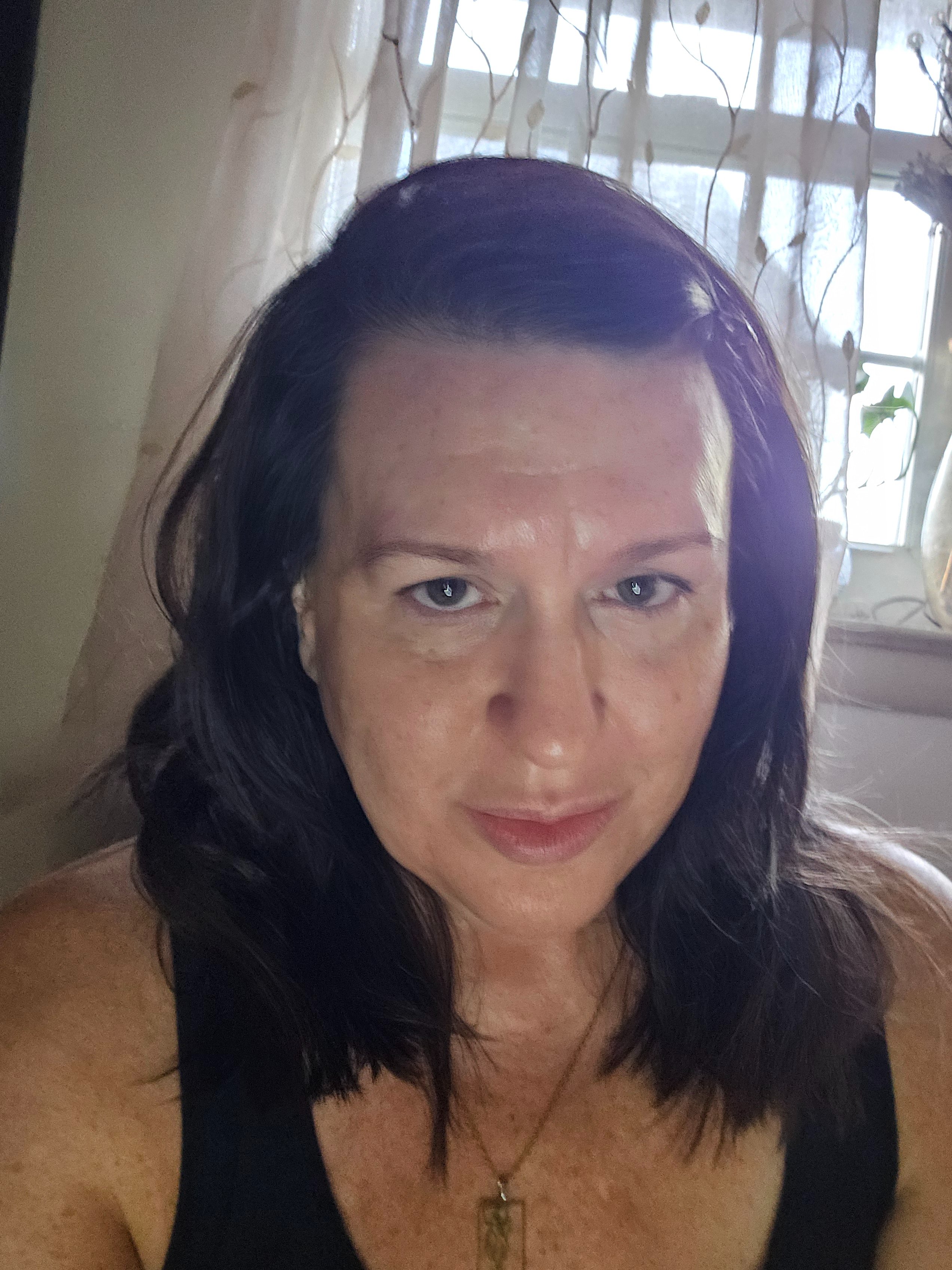 Support My Meningioma Surgery Recovery campaign photo, 4 of 5