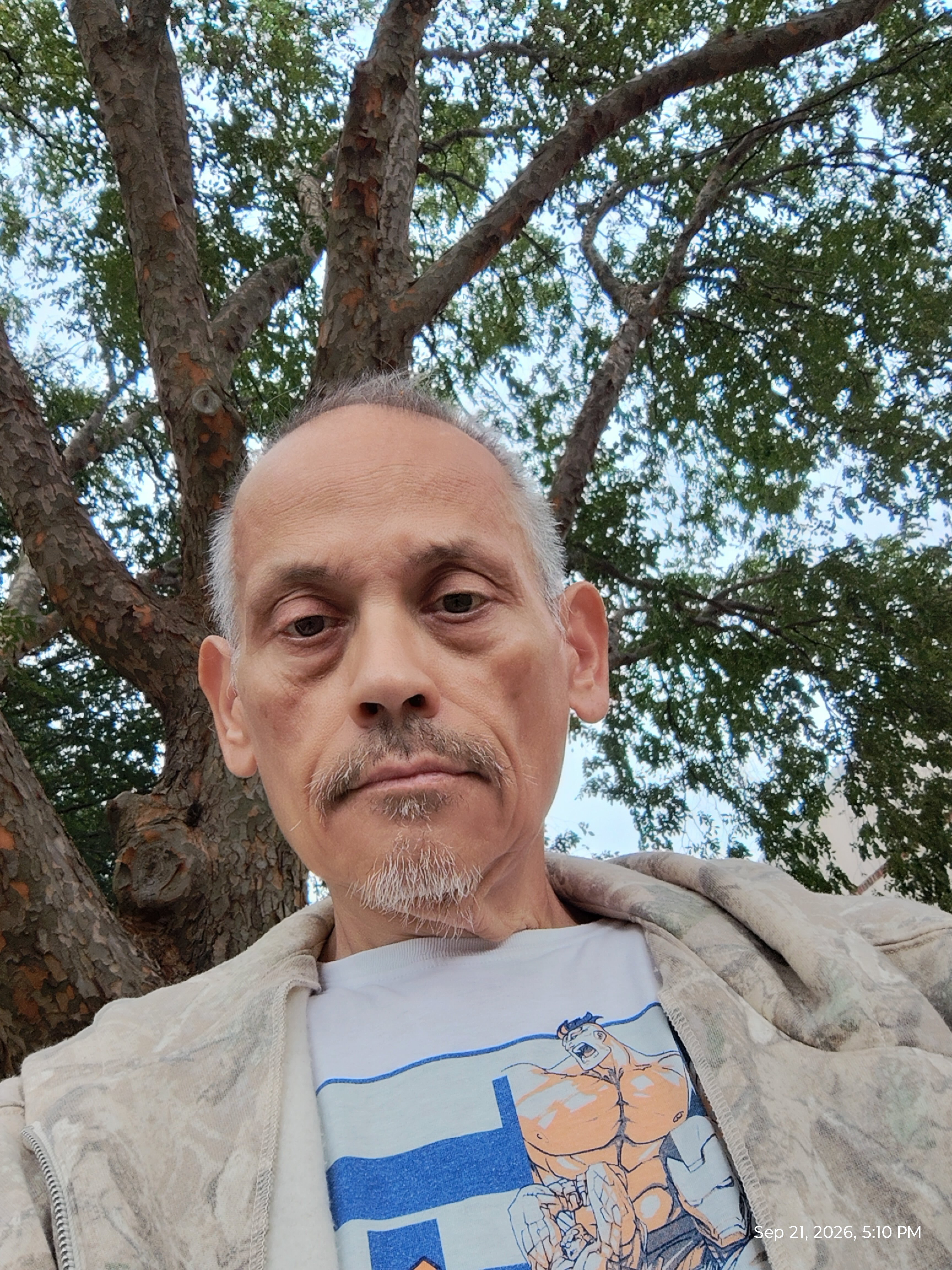 Help Tim Heal After Eye Surgery campaign photo, 6 of 8