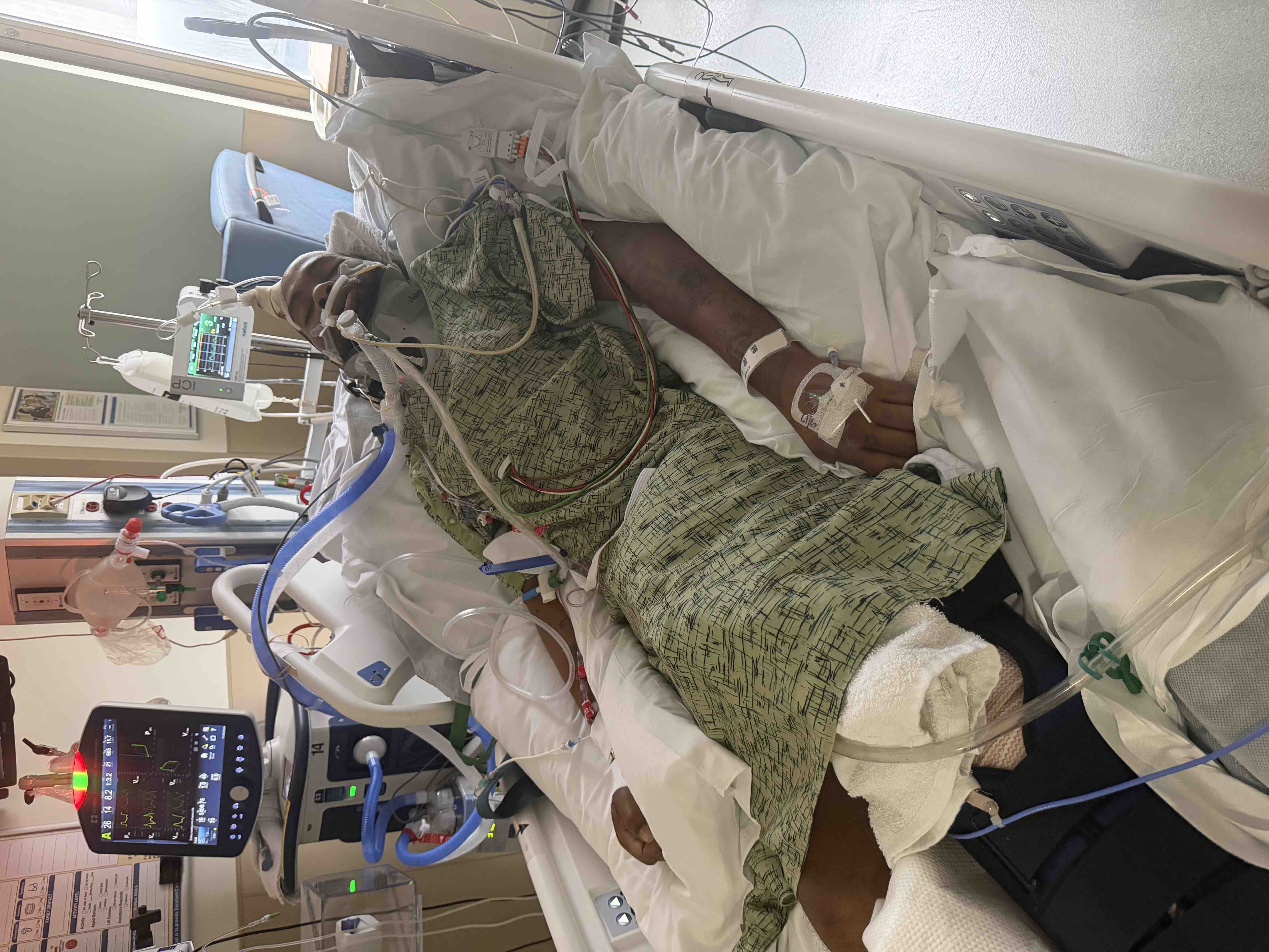 Support Curtis Henderson after a devastating hit and run campaign photo, 2 of 5