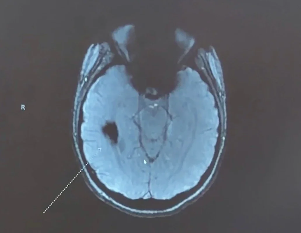 Help Taylor's journey to recovery after brain surgery campaign photo, 4 of 6