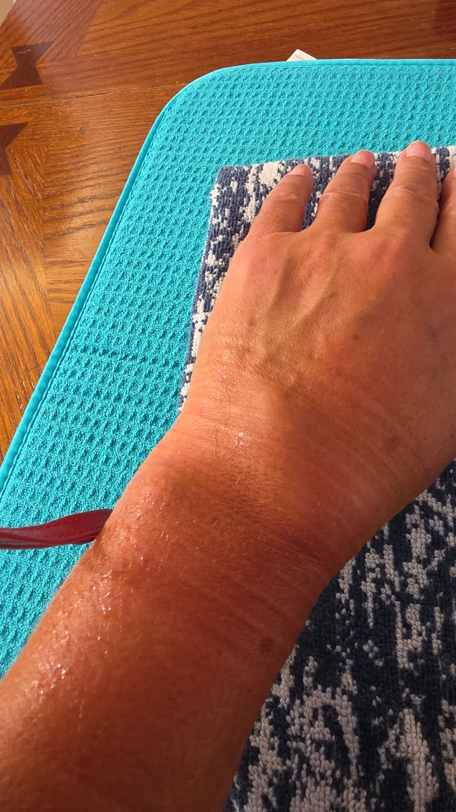 Help Gladys Get Treatment for Her Broken Wrist campaign photo, 2 of 4