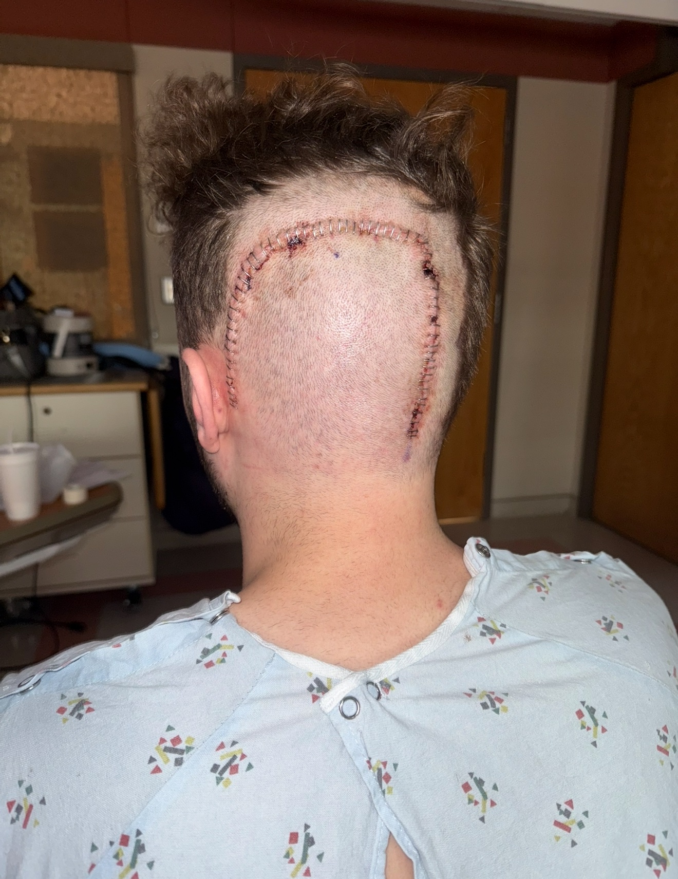 Clint's Recovery and Ongoing Care campaign photo, 4 of 9