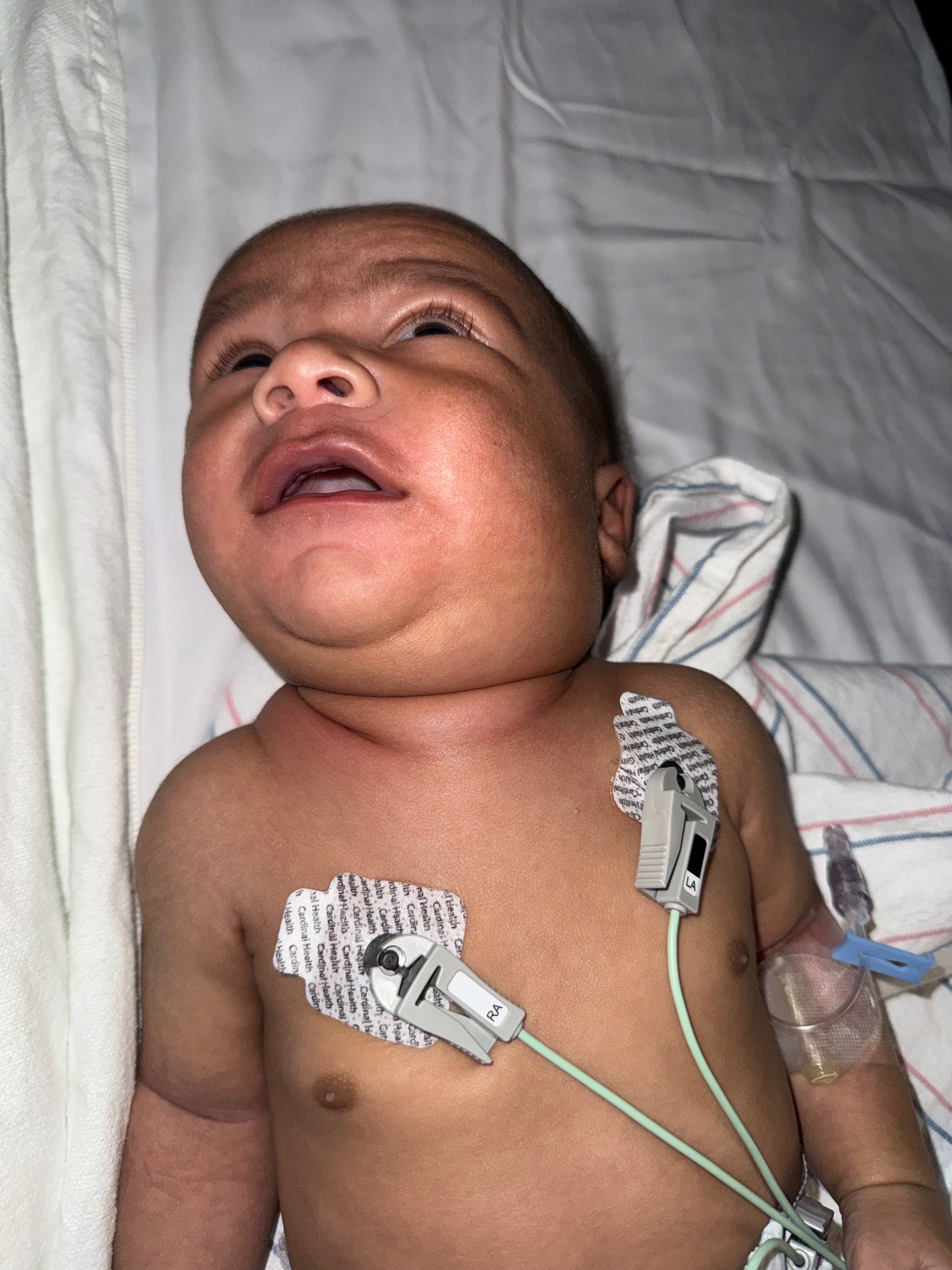 Support Baby Carter’s Recovery campaign photo, 2 of 11