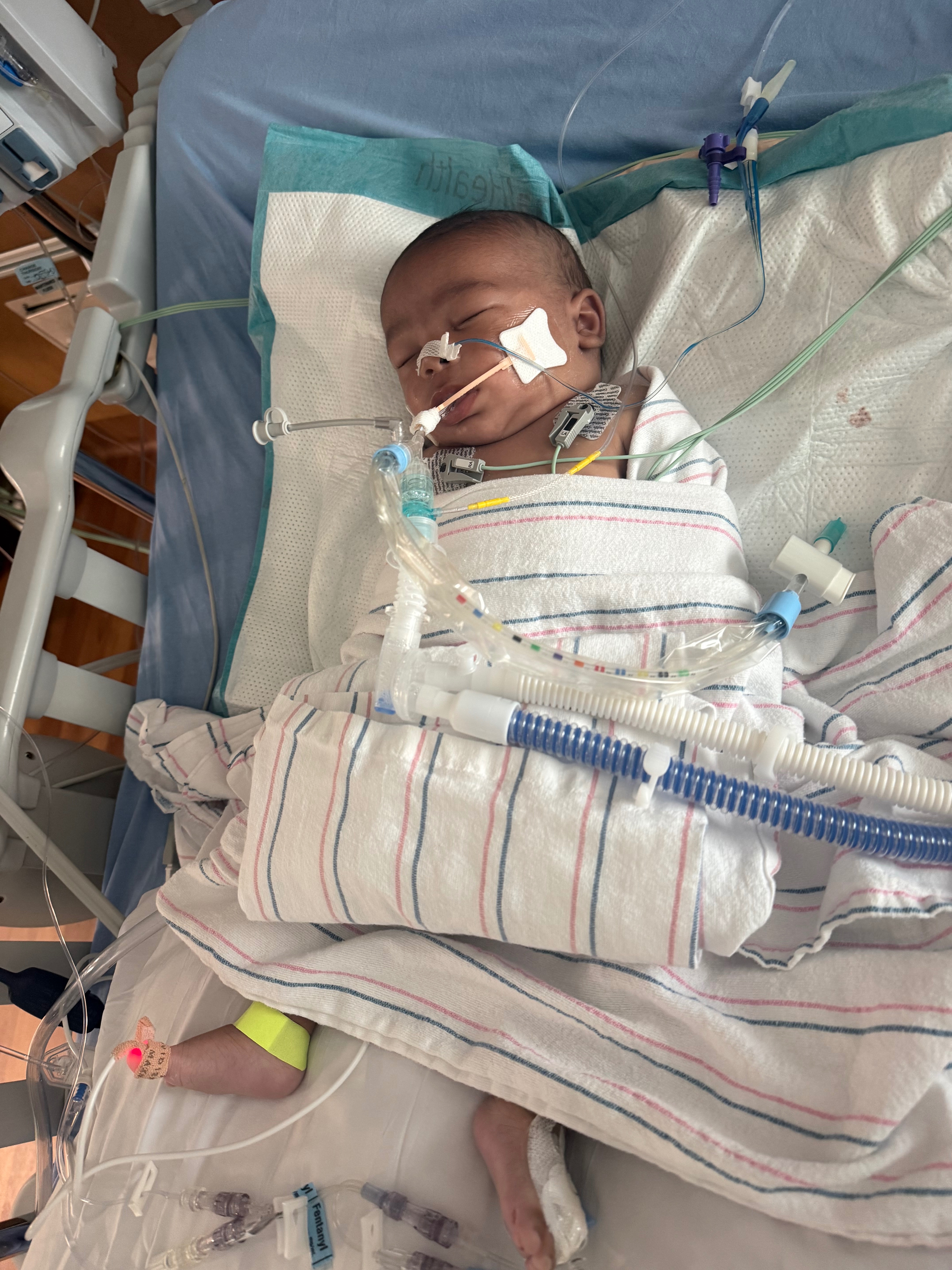 Support Baby Carter’s Recovery campaign photo, 5 of 11