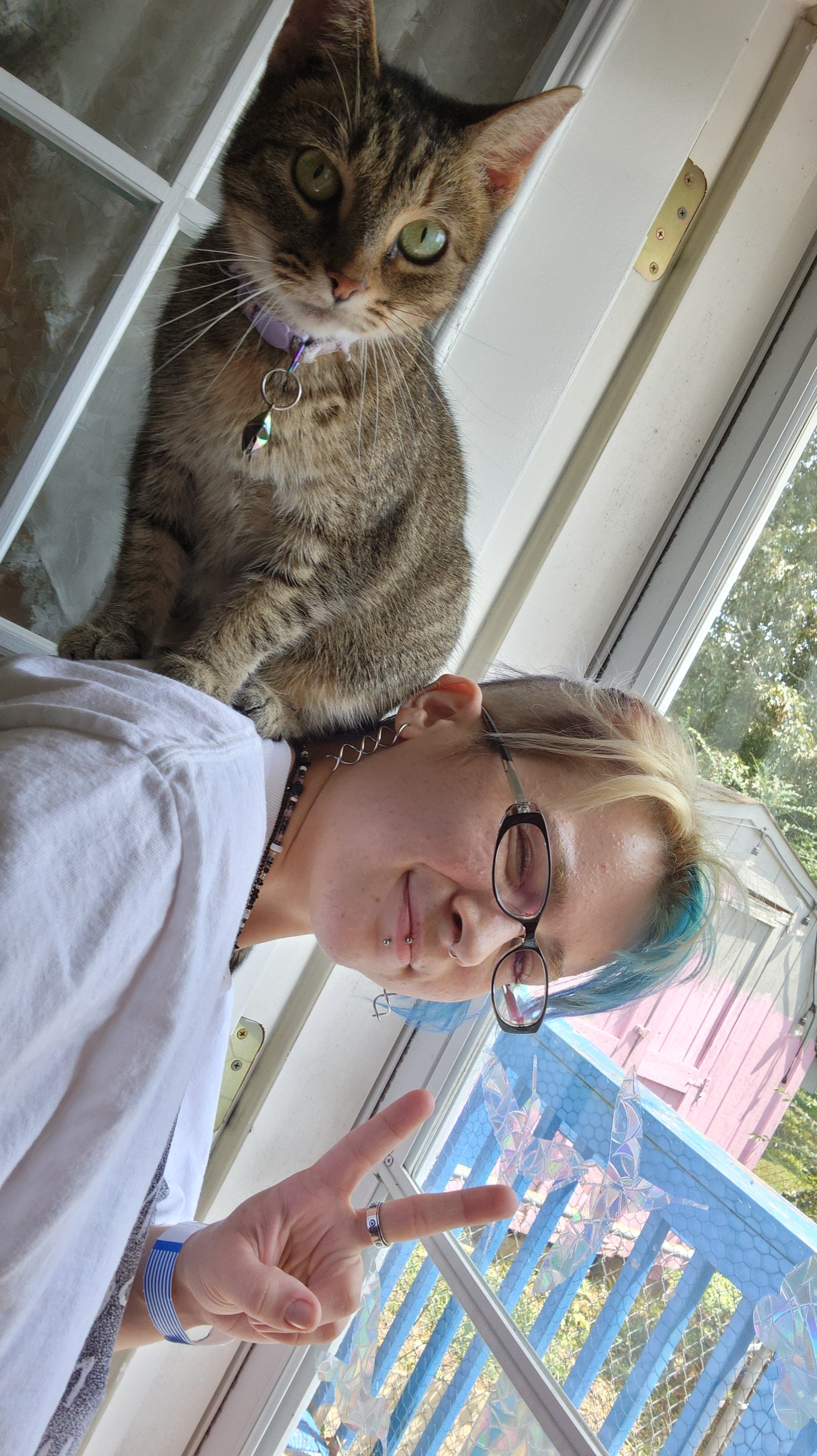 V's Life Saving Liver Transplant campaign photo, 2 of 5