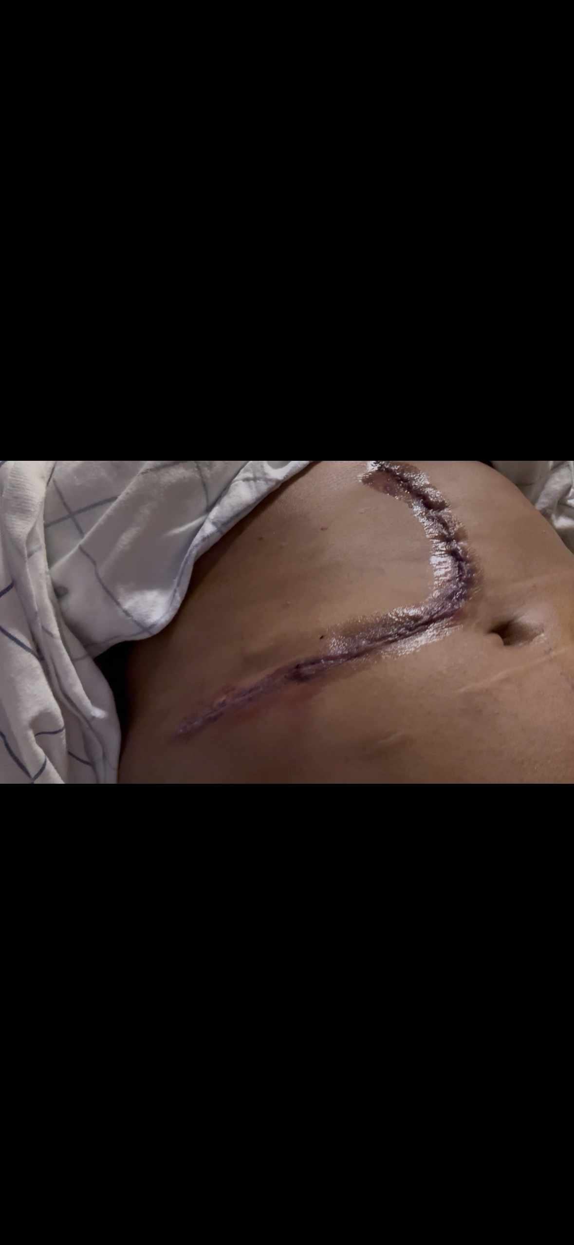 Help Gayatri Access Lifesaving Cancer Treatments campaign photo, 4 of 5