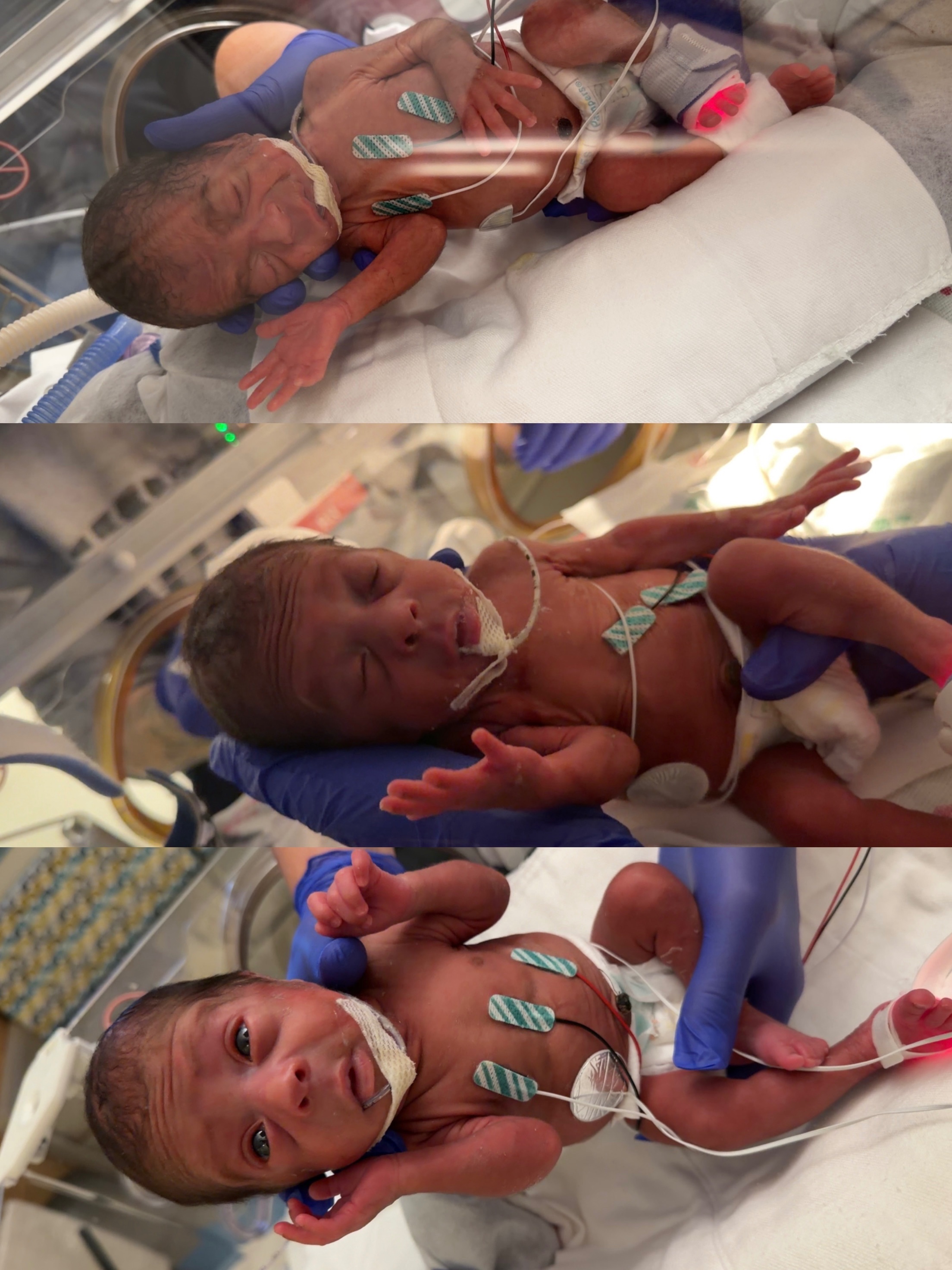 Three Babies in the NICU, One Family Holding On campaign photo, 2 of 4