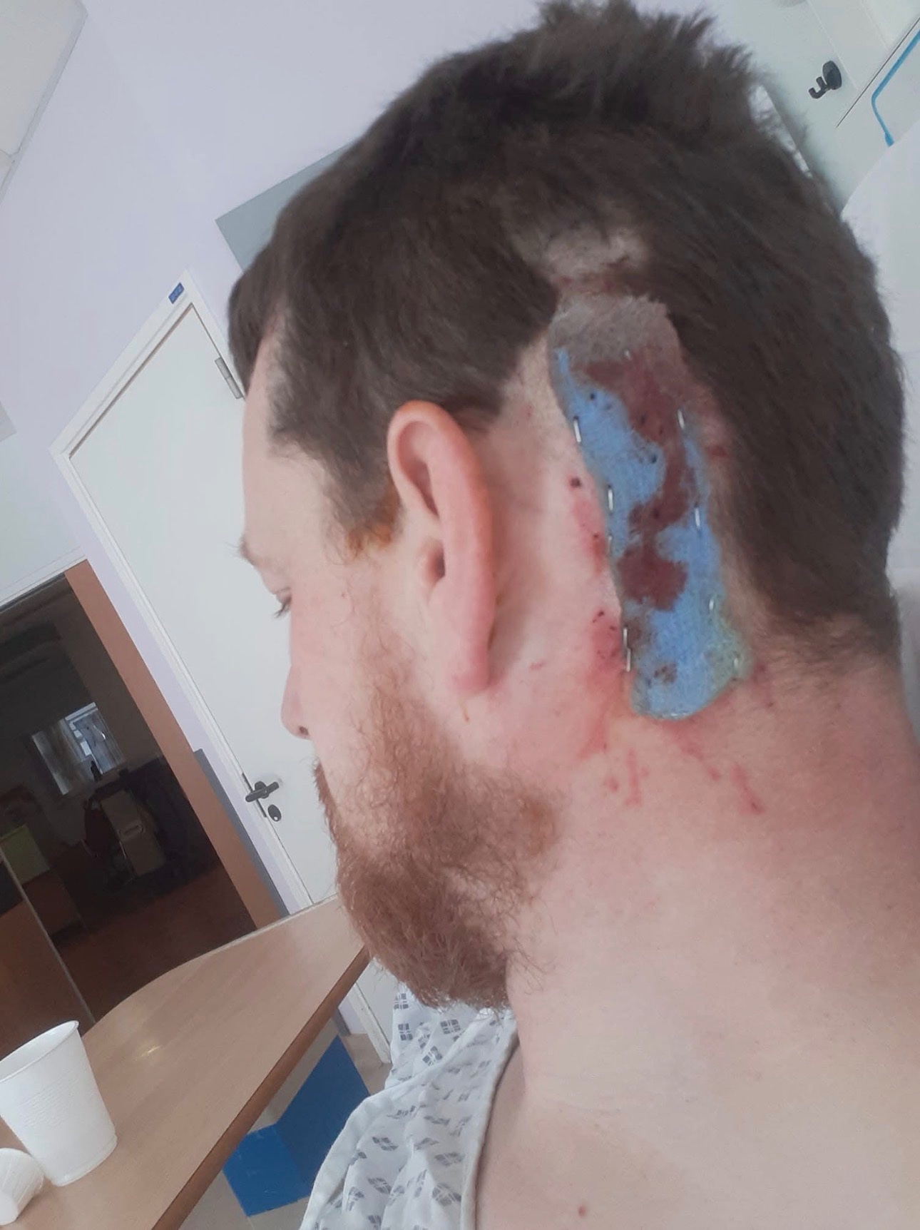 My brain tumour journey campaign photo, 4 of 7