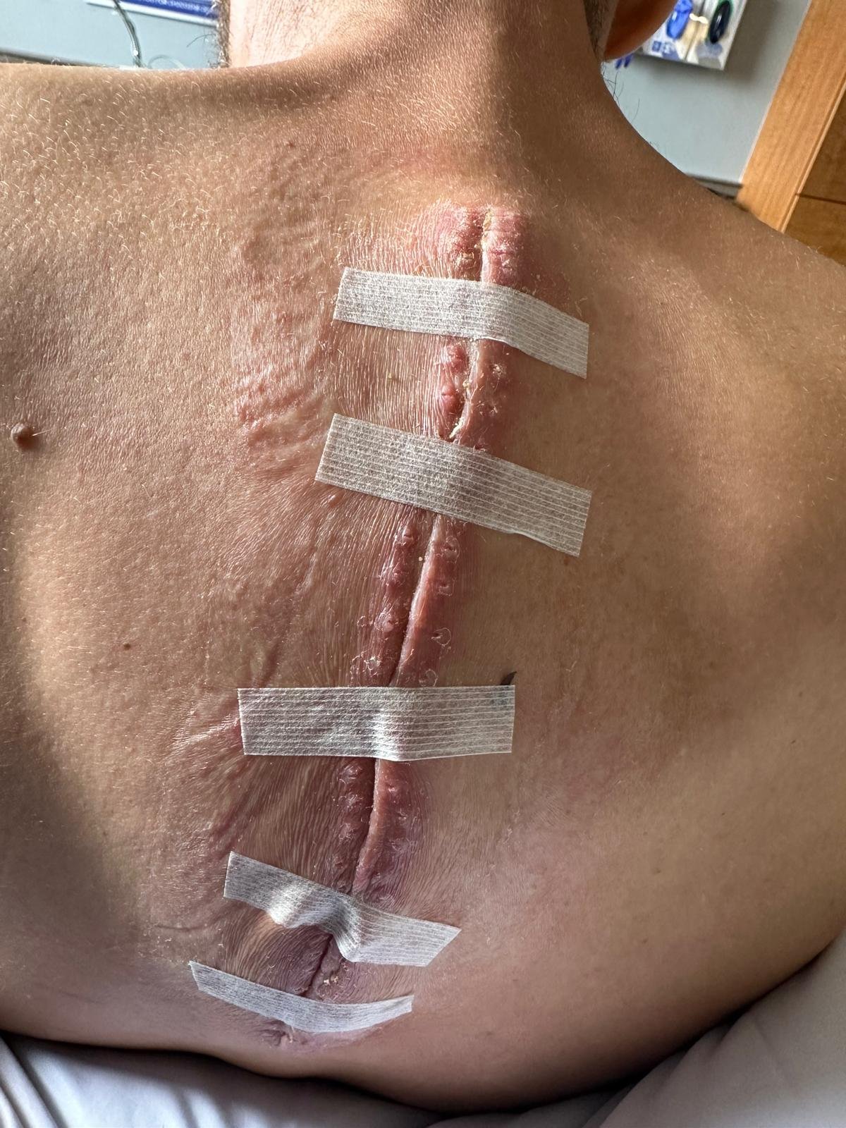 Help a Father of three After a Devastating Fall campaign photo, 2 of 8
