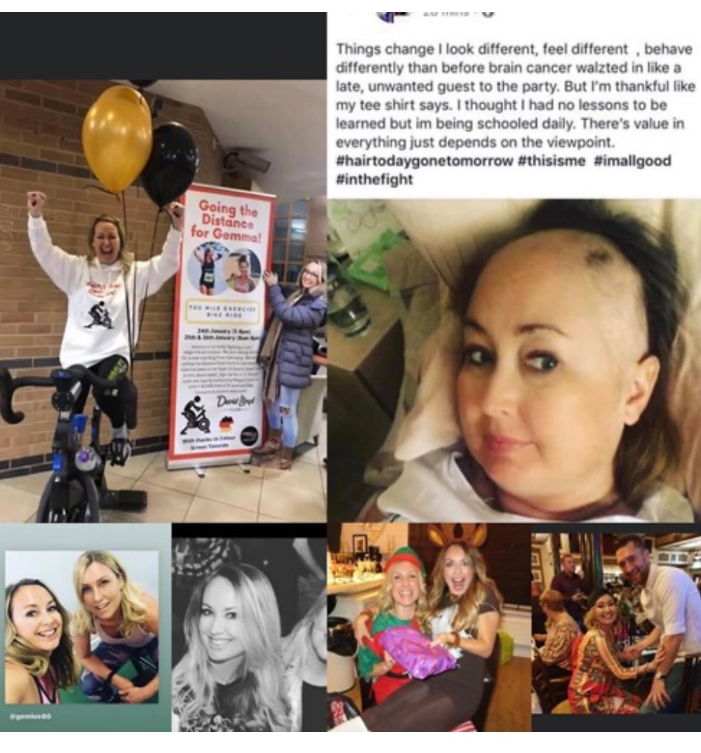 Gemma Lee’s Continued fights again Brain Cancer campaign photo, 2 of 6