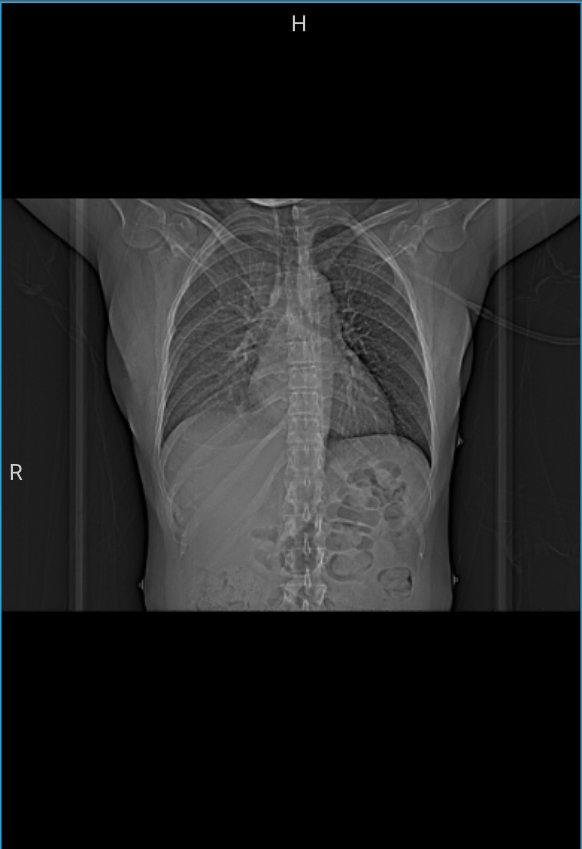 Help mij mijn medische kosten van endometriose te dragen campaign photo, 4 of 5