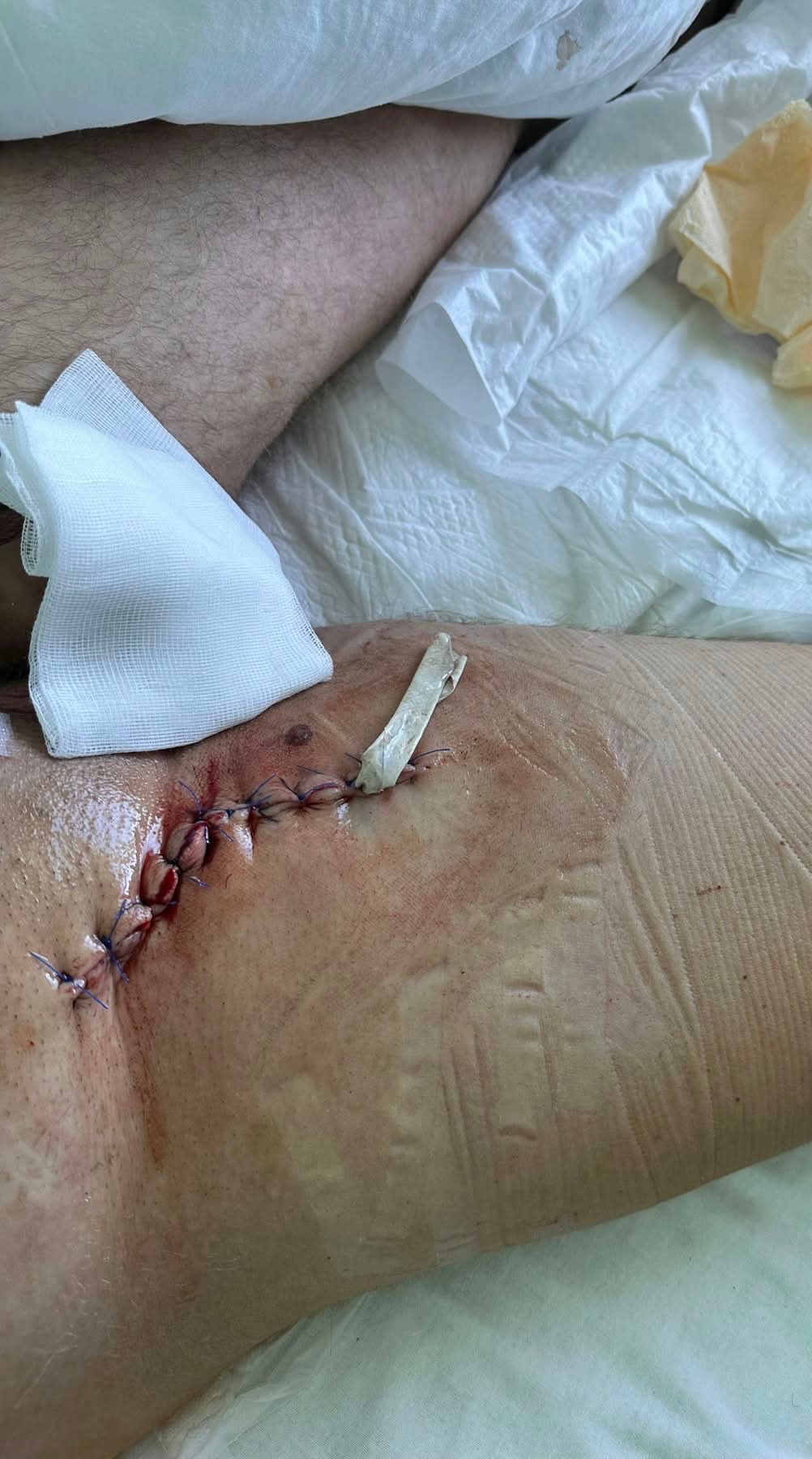 Help Roman Access Specialist Treatment After a Bike Accident campaign photo, 2 of 9