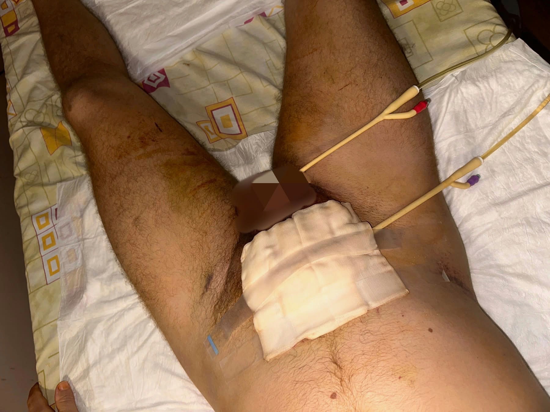 Help Roman Access Specialist Treatment After a Bike Accident campaign photo, 4 of 9