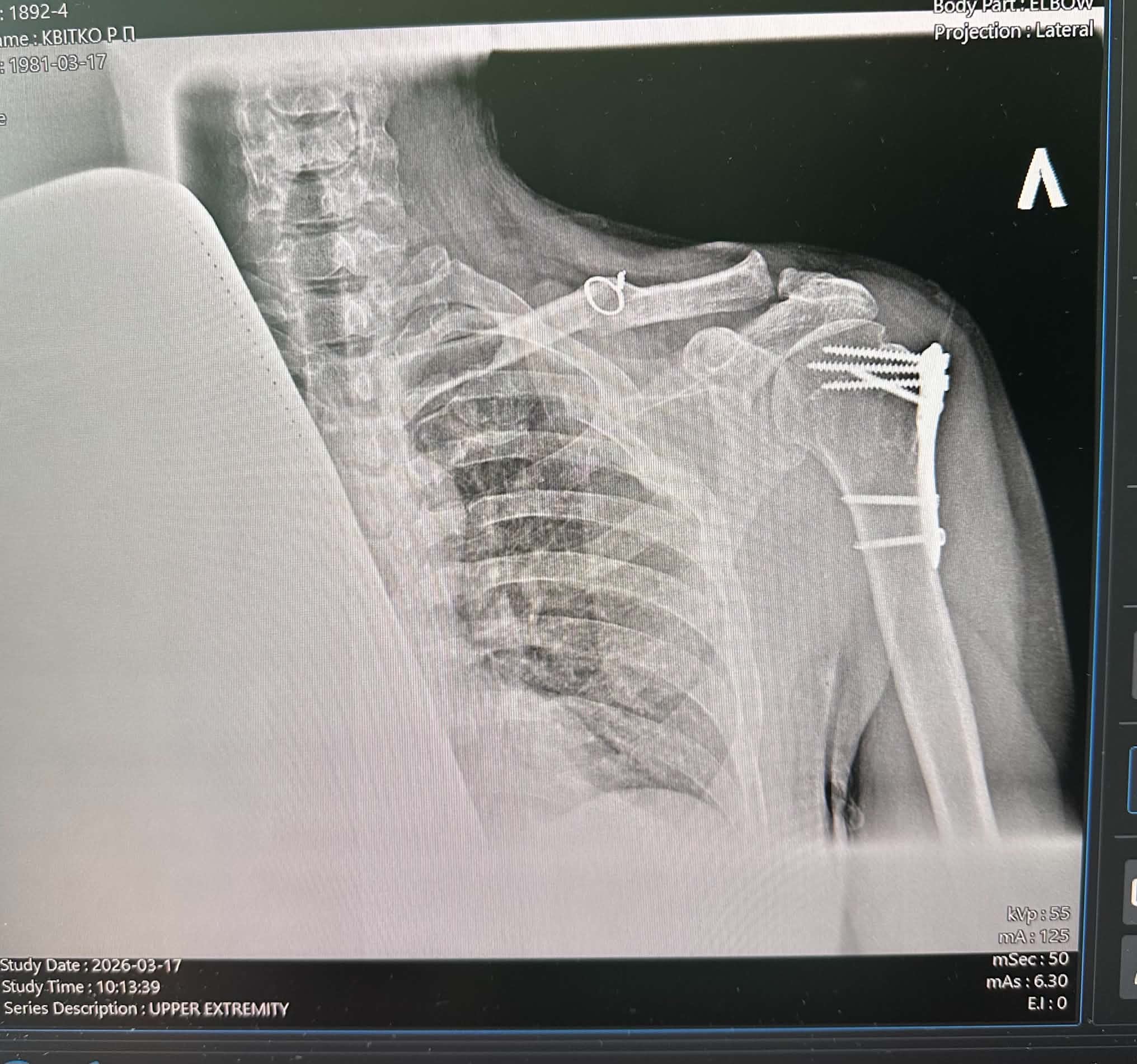 Help Roman Access Specialist Treatment After a Bike Accident campaign photo, 6 of 9