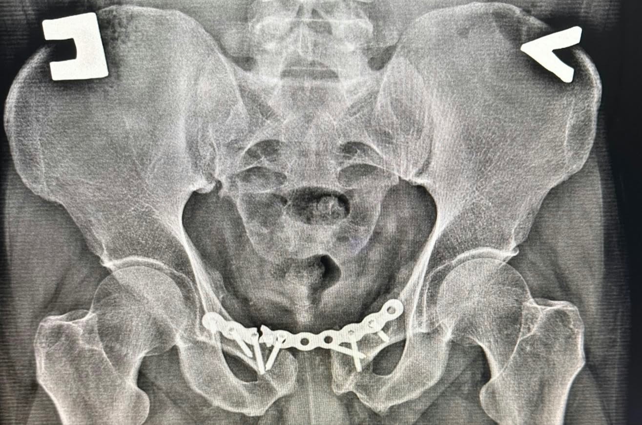 Help Roman Access Specialist Treatment After a Bike Accident campaign photo, 7 of 9