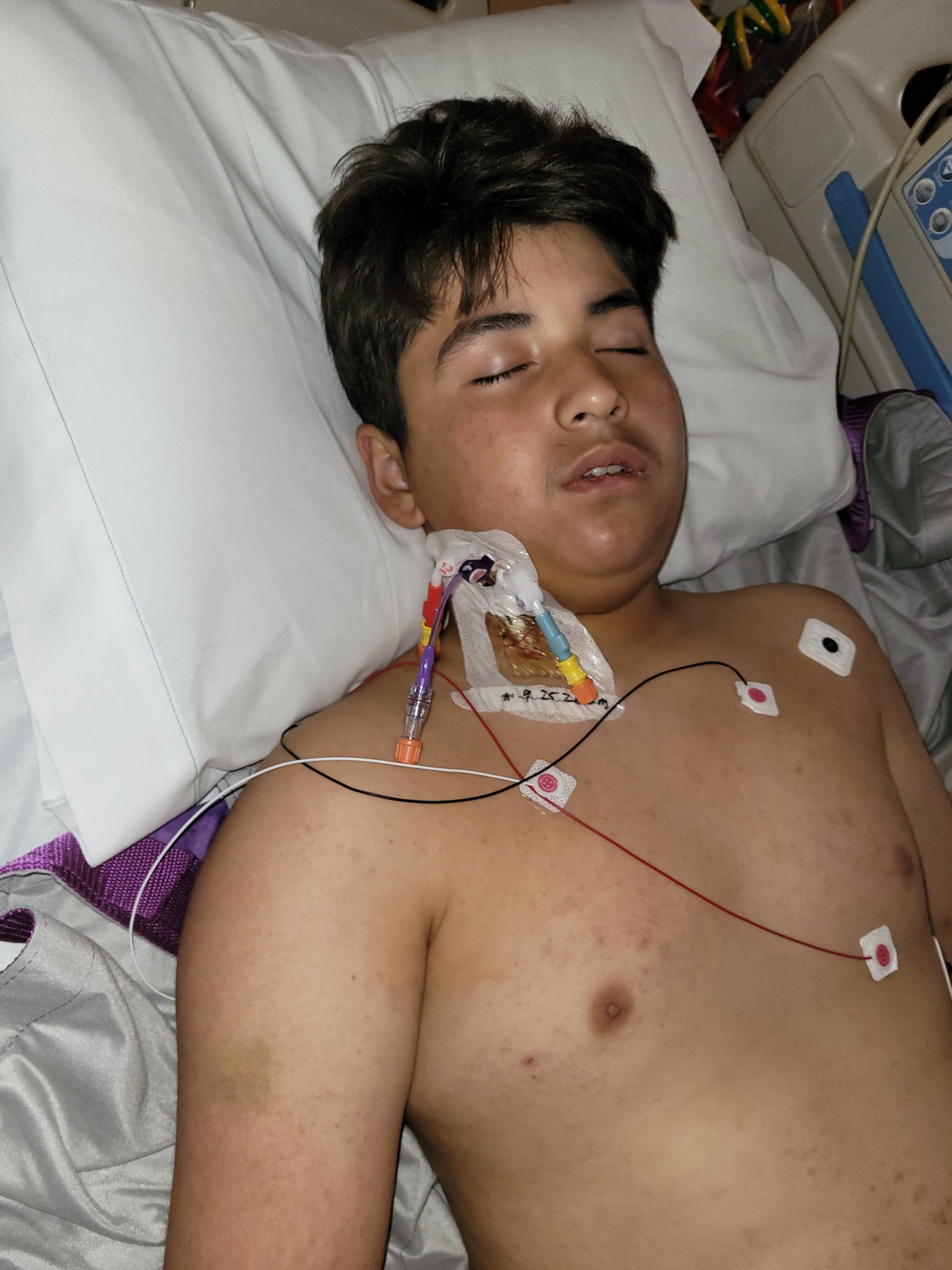 Support Joseph Vazquez's West Nile Virus Rare Complications campaign photo, 8 of 9