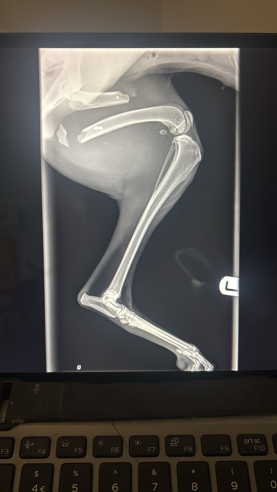 Whippi's Broken Leg campaign photo, 2 of 8