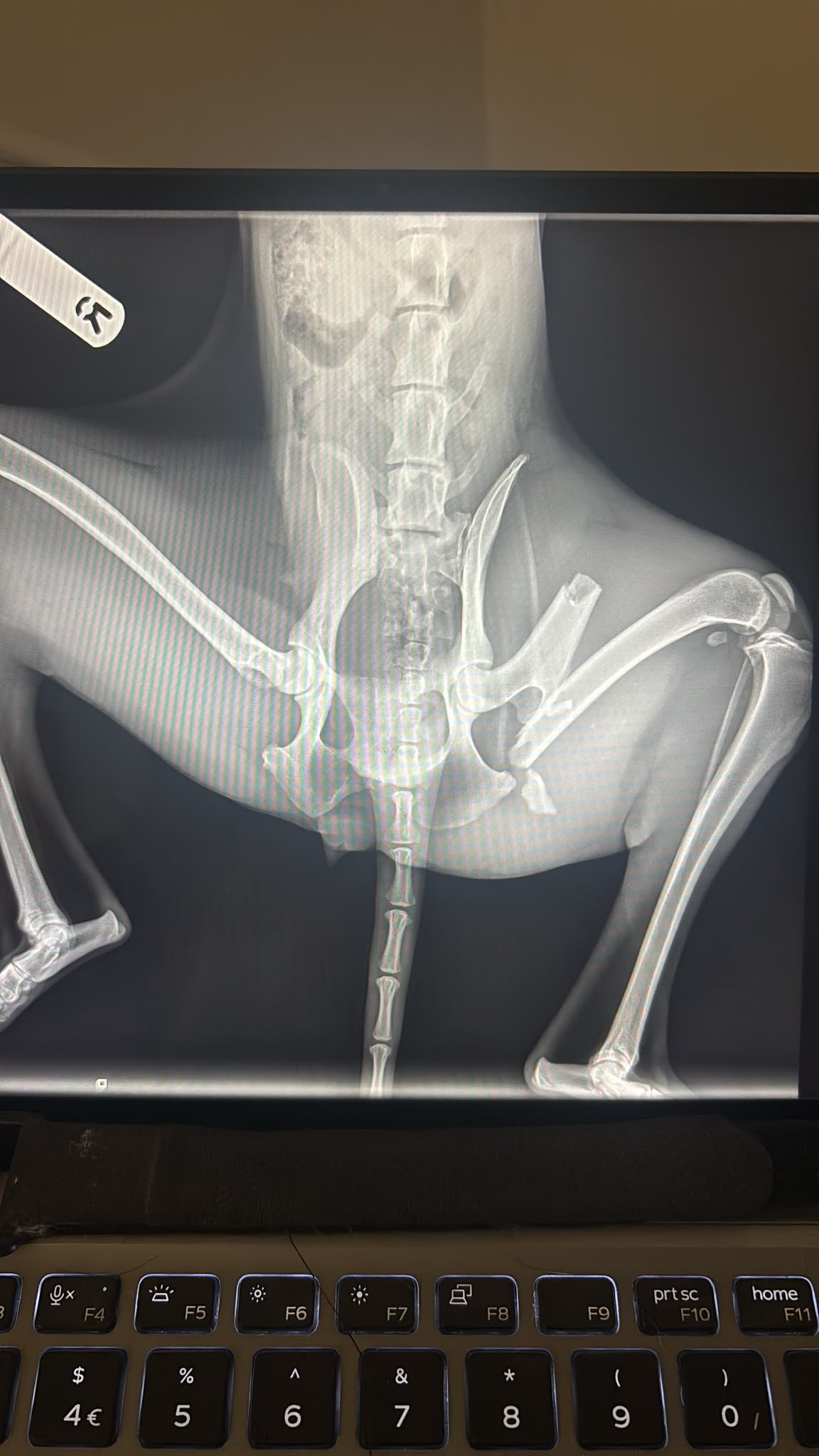 Whippi's Broken Leg campaign photo, 4 of 8