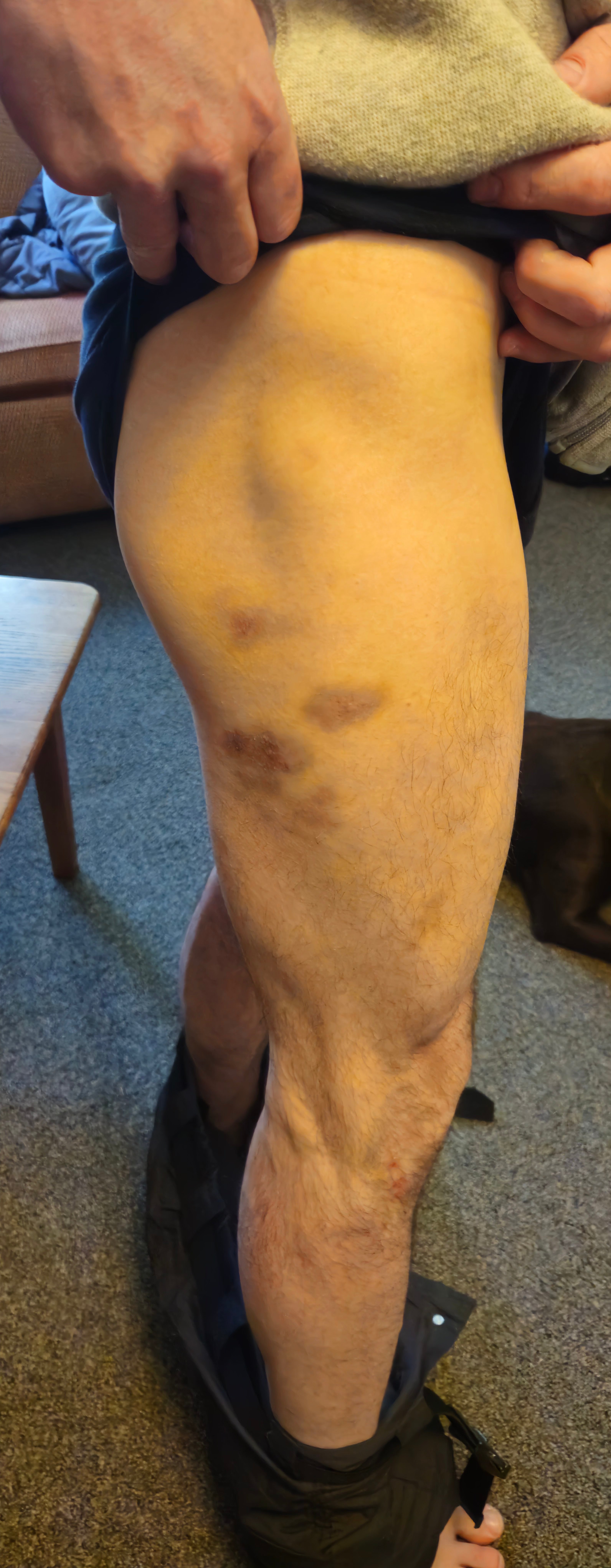 Help Miki Stay Housed and Recover After Harm in State Police campaign photo, 4 of 5