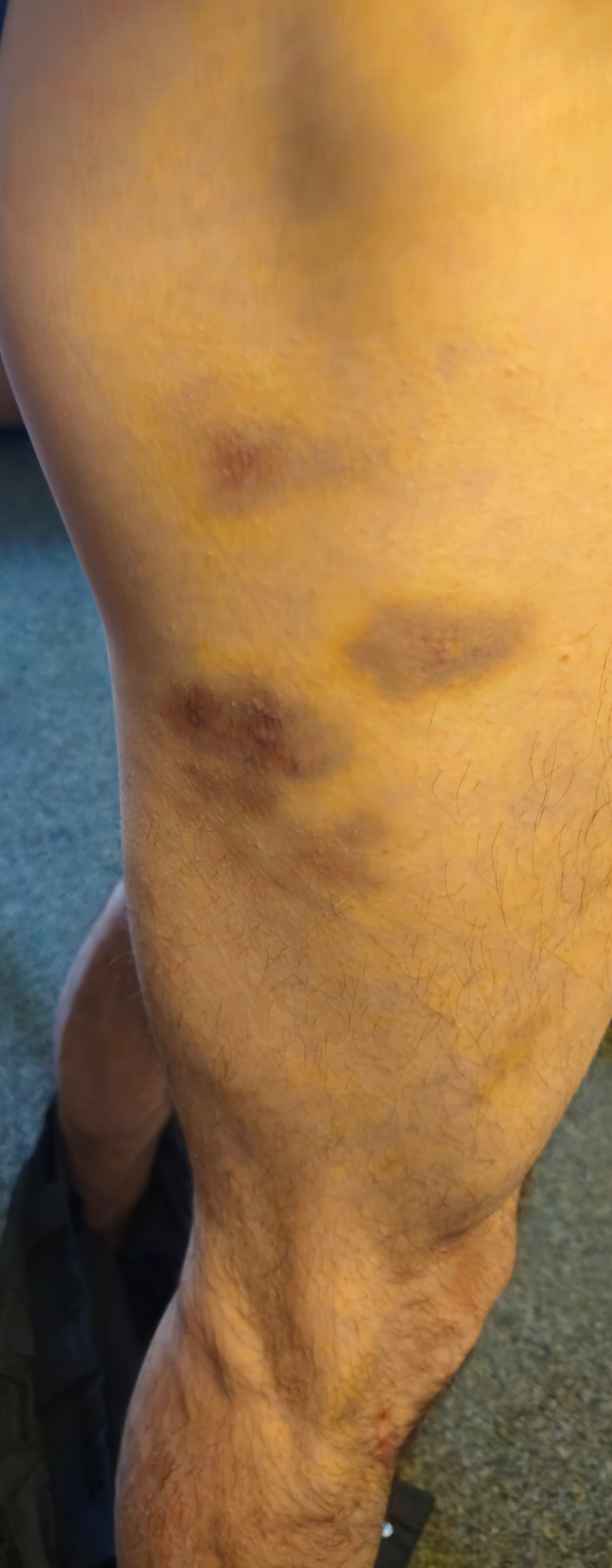 Help Miki Stay Housed and Recover After Harm in State Police campaign photo, 2 of 5