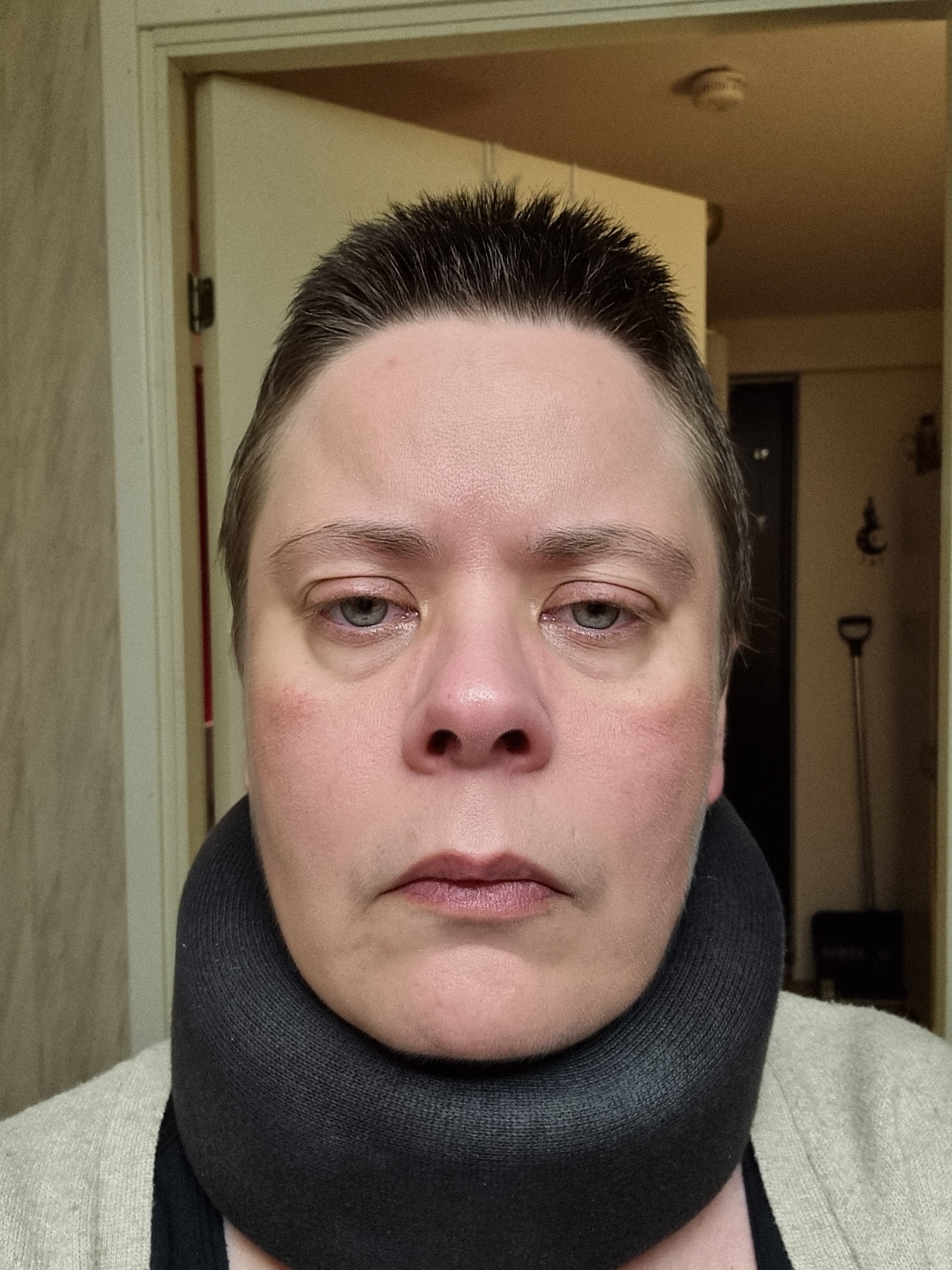 Hjälp Therese att få livsnödvändig vård utomlands campaign photo, 6 of 8