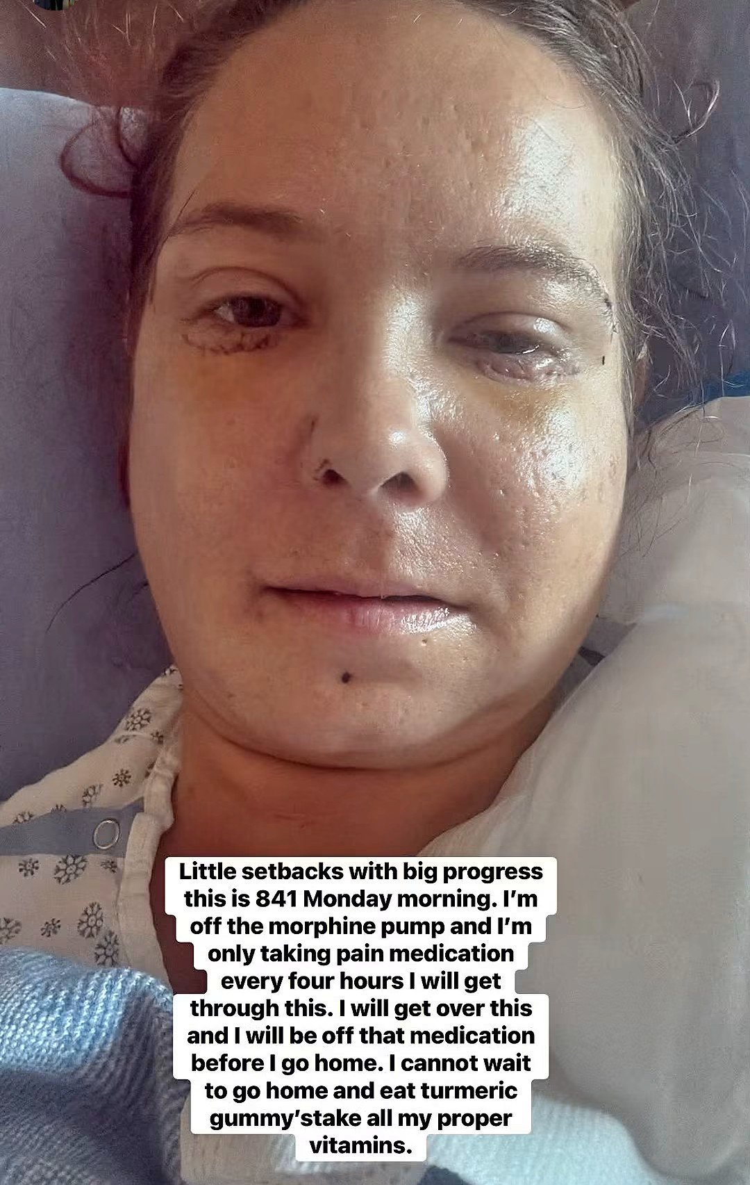 Help Brittany focus on healing and not finances campaign photo, 6 of 8