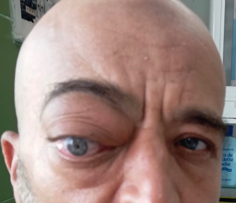Foto van campagne Help onze broeder met een dringende oogoperatie in Marokko, 2 van 4