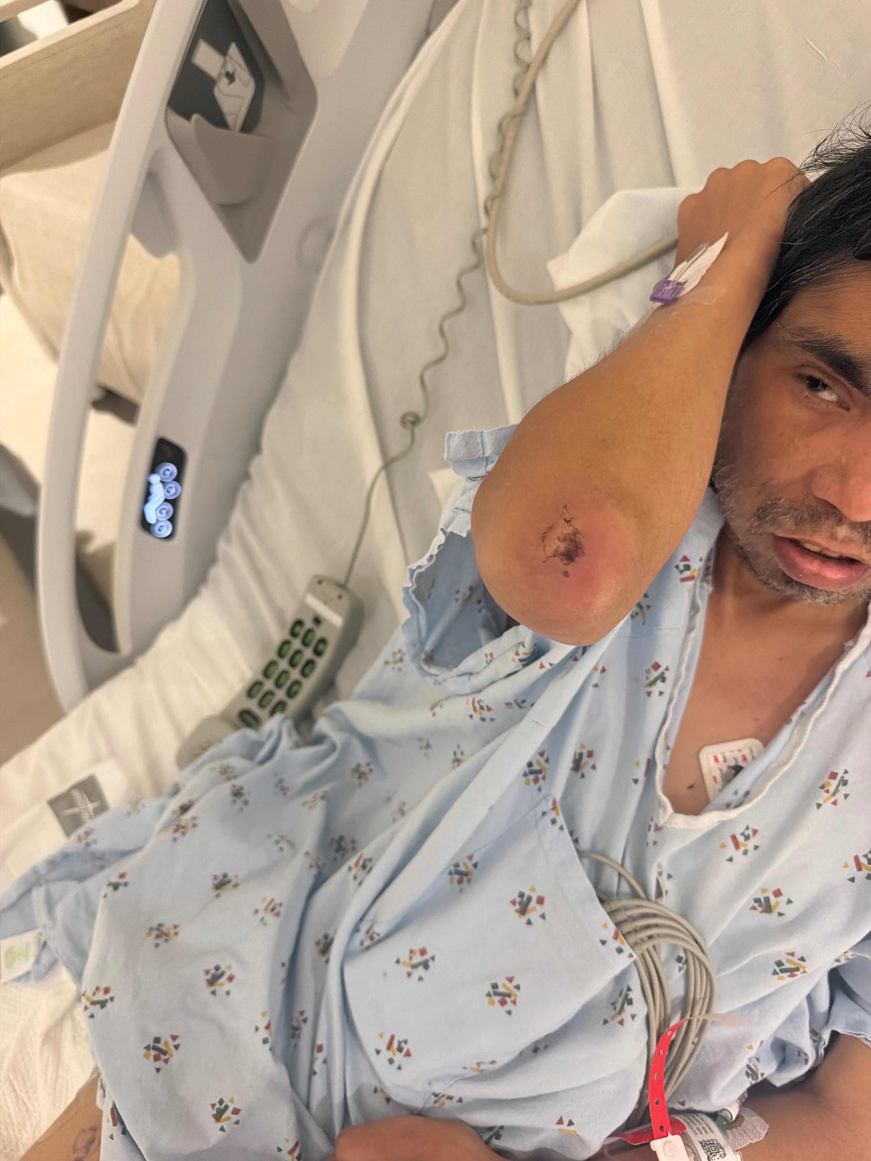 Support My Brother After Hit and Run campaign photo, 7 of 8